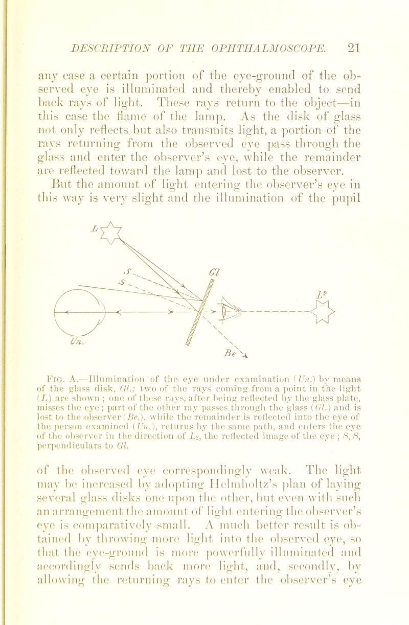 any ease a certain portion of the eye-ground of the ob- served eye is illurainated and thereby enabled to send back rays of light. These rays return to the object—in this case the flame of the lamp. As the disk of glass not only reflects but also transmits light, a portion of the rays returning from the observed eye pass through tlie glass and enter the observer’s eye, while the remainder are reflected toward the lamp and lost to the observer. But the amount of light entering the observer’s eye in this way is very slight and the illumination of the pupil Fig. A.—Illumination of the eye linder examination (Un.) by meana of the glass disk, Gl.; two of the rays coming from a point in the light (L) are shown ; onc of these rays, ai'ter heilig reflected by the glass plate, misses the eye ; part of the other ray passes through the glass (GL) and is lost to the observer (Be.), while the remainder is reflected into the eye of the person examined (Un.), returns by the sarne path, and enters the eye of the observer in the direetion of Ls, the reflected Image of the eye ; 8, 8, perpendiculars to GL of the observed eye corrcspondingly weak. The light may be inereased byadopting Helinholtz’s plan of laying several glass disks one upon the other, buteven with such an arrangement the amount of light entering the observer’s eye is comparatively small. A much better result is ob- tained by throwing more light into the observed eye, so that the eye-ground is more powerfully illuminated and aeeordingjy sends back more light, and, seeondly, by allowing the returning rays to enter the observer’s eye