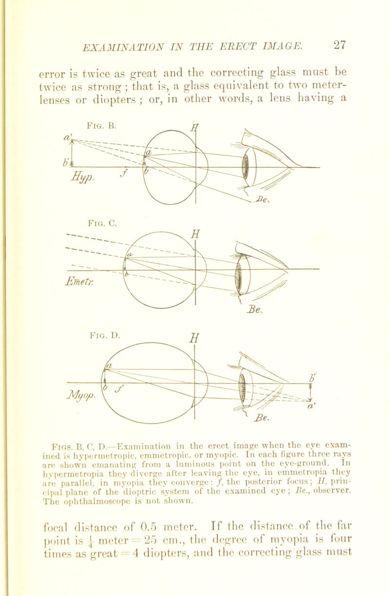 error is twice as great and tlie correcting glass must be twice as strong ; that is, a glass equivalent to two meter- lenses or diopters ; or, in other words, a lens having a Fios. B, C, D.—Examination in the crcct itnage when the eye exam- ined is hypermetropic, emmetropic, or myopie. In eaeh figure three rays are shown emanating from a lutninous point on the eyc-ground. In hypermetropia they divcrge alter leaving the eye, in emmetropia they are parallel, in myopia tliey convcrge:/, the posterior foeus; II, Prin- cipal plane of the dioptric System of the examined eye; Be., observer. The ophthalmoscope is not shown. focal distance of 0.5 meter. If tlie distance of the far point is | meter = 25 cm., the degree of myopia is four times as great 4 diopters, and the correcting glass must