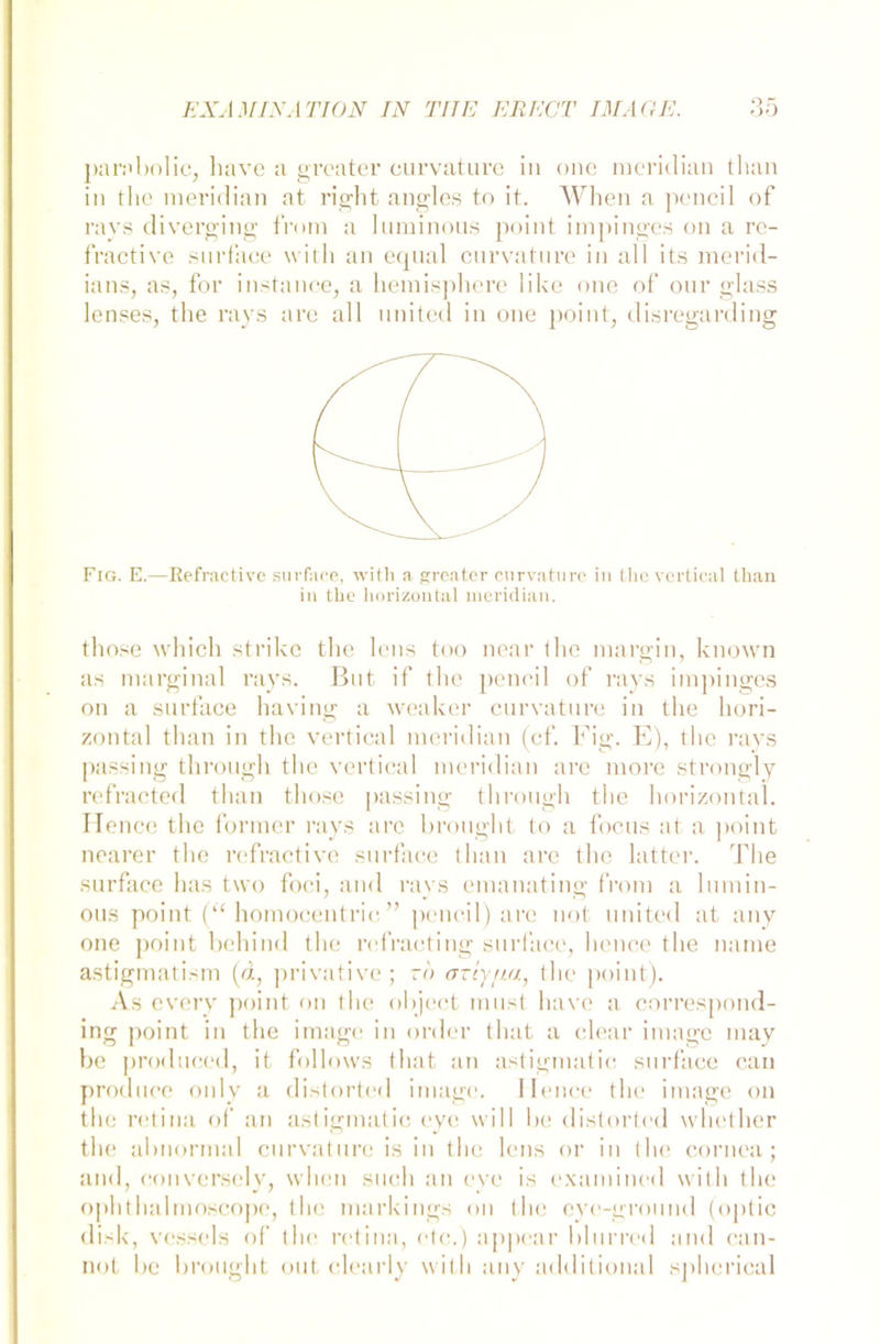 parabolic, liave a groater curvature in one meridian than in thc meridian at right augles to it. When a pencil of ravs di verging from a luminous point impinges on a re- fractive surface with an equal curvature in all its merid- ians, as, for instance, a liemisphere like one of our glass lenses, the rays are all united in one point, disregarding Fig. E.—Eefractivc surface, with a greater curvature in thc vertical than in tlie horizontal meridian. tho.se which strike the lens too near ihe margin, known as marginal rays. But if the pencil of rays impinges on a surface having a weaker curvature in the hori- zontal than in the vertical meridian (cf. Fig. E), the rays passing through the vertical meridian are more strongly refracted than those passing through the horizontal. Ilence the formet- rays are brought to a focus at a point nearer the refractive surface than are the latter. The surface has tvvo foci, and rays emanating from a lumin- ous point (“ homocentrio ” pencil) are not united at any orte point behind the refracting surface, hence the name astigmatism (d, privative; to cniyu.a, the point). As every point on the object must liave a correspond- ing point in the image in order that a clear image may be produced, it follows that an astigmatie surface can produce only a distorted image. Ilence the image on the retina of an astigmatie eye will be distorted whcther the abnormal curvature is in the lens or in the cornea; and, conversely, when such an eye is examined with the ophthalmoscope, the markings on the eye-ground (optic disk, vessels of the retina, etc.) appear blurred and can- not be brought out clearly with any additional sphcrical