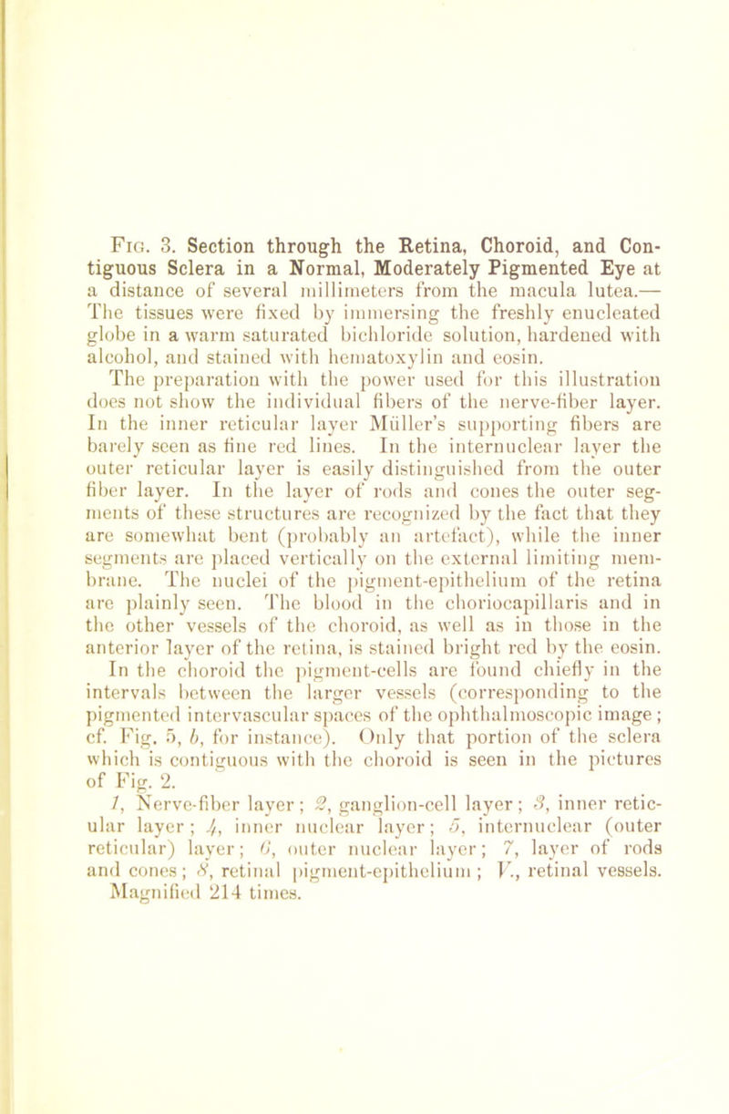 tiguous Sclera in a Normal, Moderately Pigmented Eye at a distance of several millimeters from the macula lutea.-—- The tissues were fixed by immersing the freshly enucleated globe in a warm saturated bichloride solution, hardened with alcohol, and stained with hematoxylin and eosin. The preparation with the power used for this illustratiou does not show the individual fibers of the nerve-fiber layer. In the inner reticular layer Miiller’s supporting fibers are barely seen as fine red lines. In the internuclear layer the outer reticular layer is easily distinguished from the outer fiber layer. In the layer of rods and cones the outer Seg- ments of these structures are recognized by the fact that they are somewhat bent (probably an artefact), while the inner Segments are placed vertically on the external limitiug raem- brane. The nuclei of the pigment-epithelium of the retina are plainly seen. The blood in the choriocapillaris and in the other vessels of the choroid, as well as in those in the anterior layer of the retina, is stained bright red by the eosin. In the choroid the pigment-cells are found chiefly in the intervals between the larger vessels (corresponding to the pigmented intervascular spaces of the ophthalmoscopic image ; cf. Fig. 5, b, for instance). Only that portion of the sclera which is contiguous with the choroid is seen in the pietures of Fig. 2. 1, Nerve-fiber layer; 2, ganglion-cell layer; 3, inner retic- ular layer; 4, inner nuclear layer; 5, internuclear (outer reticular) layer; G, outer nuclear layer; 7, layer of rods and cones; 8, retinal pigment-epithelium; V., retinal vessels. Magnified 214 times.