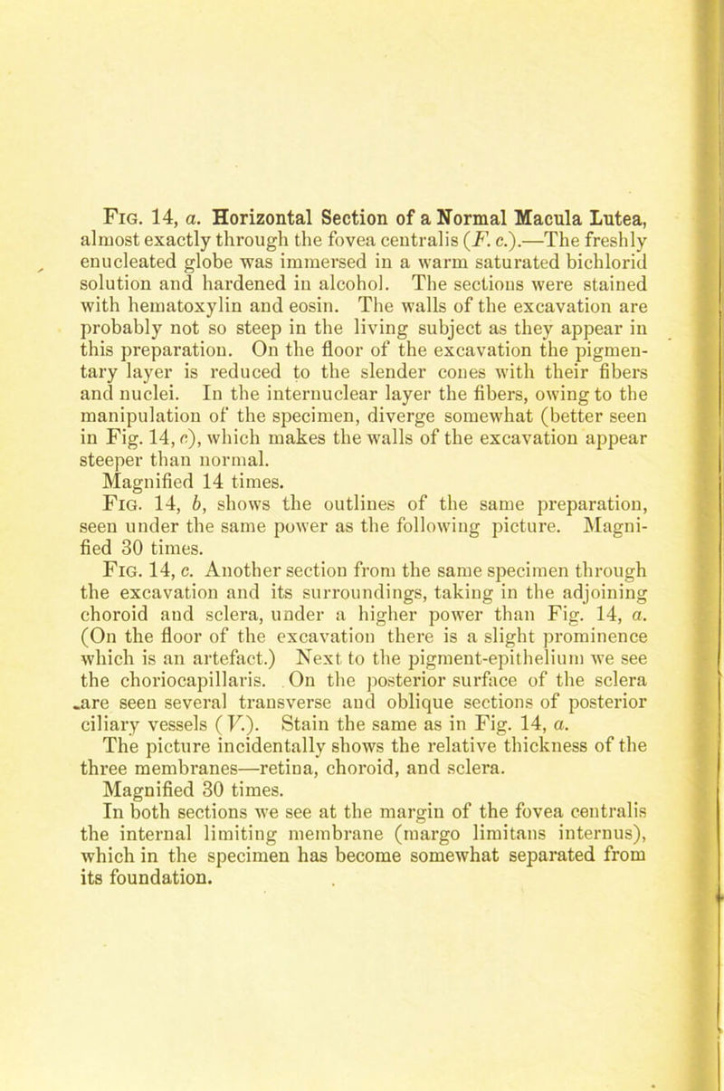 Fig. 14, a. Horizontal Section of a Normal Macula Lutea, almost exactly through the fovea centralis (Fc.).—The freshly enucleated globe was immersed in a warm saturated bichlorid solution and hardened in alcohol. The sections were stained with hematoxylin and eosin. The walls of the excavation are probably not so steep in the living subject as they appear in this preparatiou. On the floor of the excavation the pigmen- tary layer is reduced to the slender cones with their fibers and nuclei. In the internuclear layer the fibers, owing to the manipulation of the specimen, diverge somewhat (better seen in Fig. 14, c), which makes the walls of the excavation appear steeper than normal. Magnified 14 times. Fig. 14, b, shows the outlines of the same preparatiou, seen under the same power as the following picture. Magni- fied 30 times. Fig. 14, c. Another section from the same specimen through the excavation and its surroundings, taking in the adjoining choroid and sclera, under a higher power than Fig. 14, a. (On the floor of the excavation there is a slight prominence which is an artefact.) Next to the pigment-epithelium we see the choriocapillaris. On the posterior surface of the sclera .are seen several transverse and oblique sections of posterior ciliary vessels ( F). Stain the same as in Fig. 14, a. The picture incidentally shows the relative thickness of the three membranes—retina, choroid, and sclera. Magnified 30 times. In both sections we see at the margin of the fovea centralis the internal limiting membrane (margo limitans internus), which in the specimen has become somewhat separated from its foundation.