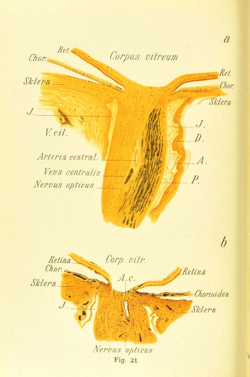 a Chor. Sklera l_ Corpus üitreum Arteria central. Vena centralis Nereus opticus ' i klera Nereus opticus Fig. 21. Ch or. Sklera Corp. üitr. Chorioidea