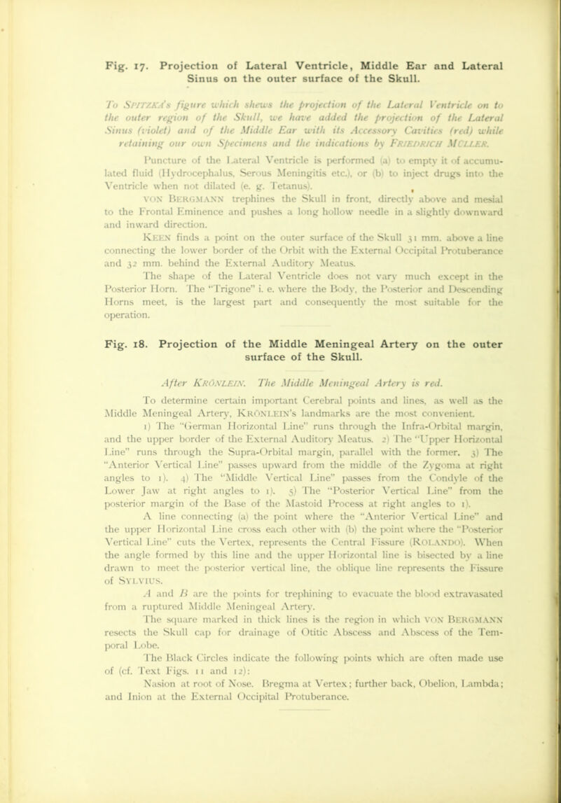 Sinus on the outer surface of the Skull. To S/'/t/.Ka’s figure which shews the projection of the Lateral Ventricle on to the outer region of the Skull, we have added the projection of the Lateral Sinus (violet) and of the Middle Ear with its Accessory Cai'ities (red) while retaining our own Specimens and the indications by FRIEDRICH Miller. Puncture of the Lateral Ventricle is performed (a) to empty it of accumu- lated fluid (Hydrocephalus, Serous Meningitis etc.), or *b) to inject drugs into die Ventricle when not dilated (e. g. Tetanus). # vox Bergmann trephines the Skull in front, direcdy above and mesial to the Frontal Eminence and pushes a long hollow needle in a slightly downward and inward direction. Keen finds a point on the outer surface of die Skull 31 mm. above a line connecting die lower border of the Orbit with the External Occipital Protuberance and 32 mm. behind the External Auditory Meatus. The shape of the lateral Ventricle does not van- much except in the Posterior Horn. The “Trigone” i. e. w here the Body, the Posterior and Descending Horns meet, is the largest part and consequently the most suitable for die operation. Fig. 18. Projection of the Middle Meningeal Artery on the outer surface of the Skull. After KRÖNLEIN. The Middle Meningeal Artery is red. To determine certain important Cerebral points and lines, as well as the Middle Meningeal Arten', KröNLEIN’s landmarks are the most convenient 1) The German Horizontal Line” runs through the Infra-Orbital margin, and the upper border of the External Auditory Meatus. 2) The “Upper Horizontal Line” runs through the Supra-Orbital margin, parallel with the former. 3) The “Anterior Vertical Line” passes upward from the middle of the Zygoma at right angles to 1). 4) The “Middle Vertical Line passes from the Condyle of die Lower Jaw at right angles to 1). 5) The “Posterior Vertical Line from the posterior margin of the Base of the Mastoid Process at right angles to 1). A line connecting (a) the point where die “Anterior Vertical Line and the upper Horizontal Line cross each other with (b) the point where the “Posterior Vertical Line” cuts the Vertex, represents the Central Fissure (Rolando). When the angle formed by this line and the upper Horizontal line is bisected by a line drawn to meet the posterior vertical line, the oblique line represents the Fissure of Sylvius. .1 and II are the points for trephining to evacuate the blood extravasated from a ruptured Middle Meningeal Artery. The square marked in thick lines is the region in which VON BERGMANN resects the Skull cap for drainage of Otitic Abscess and Abscess of the Tem- poral Lobe. 'l he Black Circles indicate the following points which are often made use of (cf. Text Figs. 11 and 12): Nasion at root of Xose. Bregma at Vertex; further back, Obelion. Lambda; and Inion at the External Occipital Protuberance.