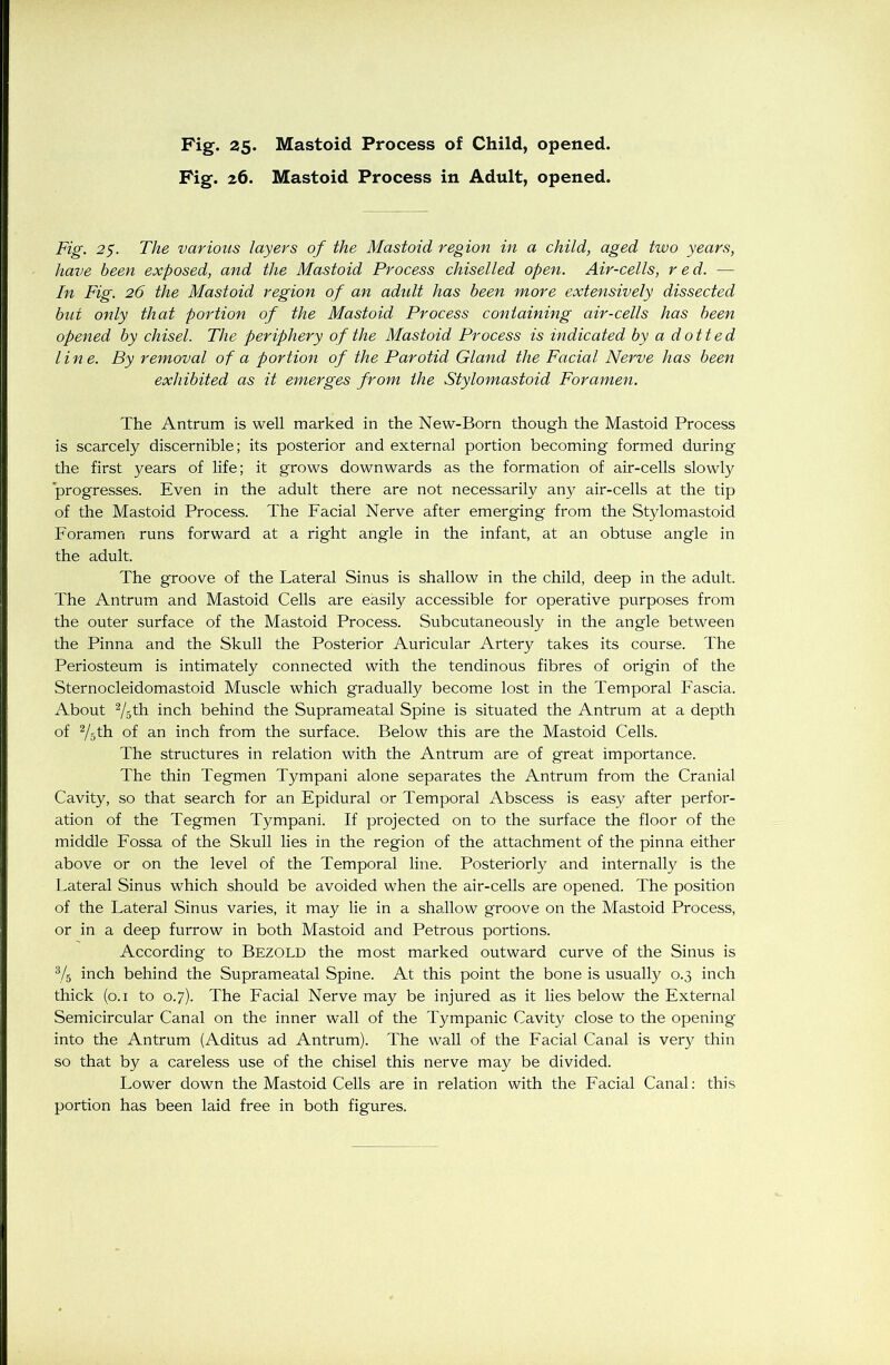 Fig. 26. Mastoid Process in Adult, opened. Fig. 25. The various layers of the Mastoid region in a child, aged two years, have been exposed, and the Mastoid Process chiselled open. Air-cells, red.— In Fig. 26 the Mastoid region of an adidt has been more extensively dissected but only that portion of the Mastoid Process containing air-cells has been opened by chisel. The periphery of the Mastoid Process is indicated by a dotted line. By removal of a portion of the Parotid Gland the Facial Nerve has been exhibited as it emerges from the Stylomastoid Foramen. The Antrum is well marked in the New-Born though the Mastoid Process is scarcely discernible; its posterior and external portion becoming formed during the first years of life; it grows downwards as the formation of air-cells slowly progresses. Even in the adult there are not necessarily any air-cells at the tip of the Mastoid Process. The Facial Nerve after emerging from the Stylomastoid Foramen runs forward at a right angle in the infant, at an obtuse angle in the adult. The groove of the Lateral Sinus is shallow in the child, deep in the adult. The Antrum and Mastoid Cells are easily accessible for operative purposes from the outer surface of the Mastoid Process. Subcutaneously in the angle between the Pinna and the Skull the Posterior Auricular Artery takes its course. The Periosteum is intimately connected with the tendinous fibres of origin of the Sternocleidomastoid Muscle which gradually become lost in the Temporal Fascia. About 2/5th inch behind the Suprameatal Spine is situated the Antrum at a depth of 2/5th of an inch from the surface. Below this are the Mastoid Cells. The structures in relation with the Antrum are of great importance. The thin Tegmen Tympani alone separates the Antrum from the Cranial Cavity, so that search for an Epidural or Temporal Abscess is easy after perfor- ation of the Tegmen Tympani. If projected on to the surface the floor of the middle Fossa of the Skull lies in the region of the attachment of the pinna either above or on the level of the Temporal line. Posteriorly and internally is the Lateral Sinus which should be avoided when the air-cells are opened. The position of the Lateral Sinus varies, it may lie in a shallow groove on the Mastoid Process, or in a deep furrow in both Mastoid and Petrous portions. According to Bezold the most marked outward curve of the Sinus is 3/5 inch behind the Suprameatal Spine. At this point the bone is usually 0.3 inch thick (0.1 to 0.7). The Facial Nerve may be injured as it lies below the Extermil Semicircular Canal on the inner wall of the Tympanic Cavity close to the opening into the Antrum (Aditus ad Antrum). The wall of the Facial Canal is very thin so that by a careless use of the chisel this nerve may be divided. Lower down the Mastoid Cells are in relation with the Facial Canal: this portion has been laid free in both figures.