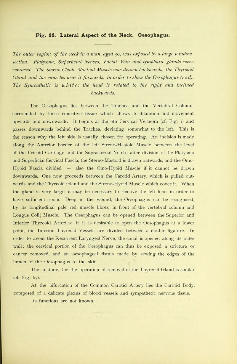 The outer region of the neck in a man, aged jo, was exposed by a large window- section. Platysma, Superficial Nerves, Facial Vein and lymphatic glands were removed. The Sterno-Cleido-Mastoid Muscle was drawn backwards, the Thyreoid Gland and the muscles near it forwards, in order to shew the Oesophagus (red). The Sympathetic is white; the head is rotated to the right and inclined backwards. The Oesophagus lies between the Trachea and the Vertebral Column, surrounded by loose conective tissue which allows its dilatation and movement upwards and downwards. It begins at the 6th Cervical Vertebra (cf. Fig. i) and passes downwards behind the Trachea, deviating somewhat to the left. This is the reason why the left side is usually chosen for operating. An incision is made along the Anterior border of the left Sterno-Mastoid Muscle between the level of the Cricoid Cartilage and the Suprasternal Notch; after division of the Platysma and Superficial Cervical Fascia, the Sterno-Mastoid is drawn outwards, and the Omo- Hyoid Fascia divided, — also the Omo-Hyoid Muscle if it cannot be drawn downwards. One now proceeds between the Carotid Artery, which is pulled out- wards and the Thyreoid Gland and the Sterno-Hyoid Muscle which cover it. When the gland is very large, it may be necessary to remove the left lobe, in order to have sufficient room. Deep in the wound, the Oesophagus can be recognised, by its longitudinal pale red muscle fibres, in front of the vertebral column and Longus Colli Muscle. The Oesophagus can be opened between the Superior and Inferior Thyreoid Arteries; if it is desirable to open the Oesophagus at a lower point, the Inferior Thyreoid Vessels are divided between a double ligature. In order to avoid the Recurrent Laryngeal Nerve, the canal is opened along its outer wall; the cervical portion of the Oesophagus can thus be exposed, a stricture or cancer removed, and an oesophageal fistula made by sewing the edges of the lumen of the Oesophagus to the skin. The anatomy for the operation of removal of the Thyreoid Gland is similar (cf. Fig. 67). At the bifurcation of the Common Carotid Artery lies the Carotid Body, composed of a delicate plexus of blood vessels and sympathetic nervous tissue. Its functions are not known.