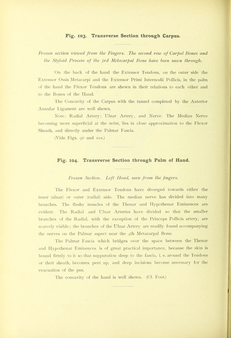 Frozen section viewed from the Fingers. The second row of Carpal Bones and the Styloid Process of the 3rd Metacarpal Bone have been sawn through. On the back of the hand the Extensor Tendons, on the outer side the Extensor Ossis Metacarpi and the Extensor Primi Internodii Pollicis, in the palm of the hand the Flexor Tendons are shewn in their relations to each other and to the Bones of the Hand. The Concavity of the Carpus with the tunnel completed by the Anterior Annular Ligament are well shewn. Note: Radial Artery; Ulnar Artery, and Nerve. The Median Nerve becoming more superficial at the wrist, lies in close approximation to the Flexor Sheath, and directly under the Palmar Fascia. (Vide Figs. 98 and 101.) Fig. 104. Transverse Section through Palm of Hand. Frozen Section. Left Hand, seen from the fingers. The P'lexor and Extensor Tendons have diverged towards either the inner (ulnar) or outer (radial) side. The median nerve has divided into many branches. The fleshy muscles of the Thenar and Hypothenar Eminences are evident. The Radial and Ulnar Arteries have divided so that the smaller branches of the Radial, with the exception of the Princeps Pollicis artery, are scarcely visible; the branches of the Ulnar Artery are readily found accompanying the nerves on the Palmar aspect near the 4th Metacarpal Bone. The Palmar Fascia which bridges over the space between the Thenar and Hypothenar Eminences is of great practical importance, because the skin is bound firmly to it so that suppuration deep to the fascia, i. e. around the Tendons or their sheath, becomes pent up, and deep incisions become necessary for the evacuation of the pus. The concavity of the hand is well shewn. (Cf. Foot.)