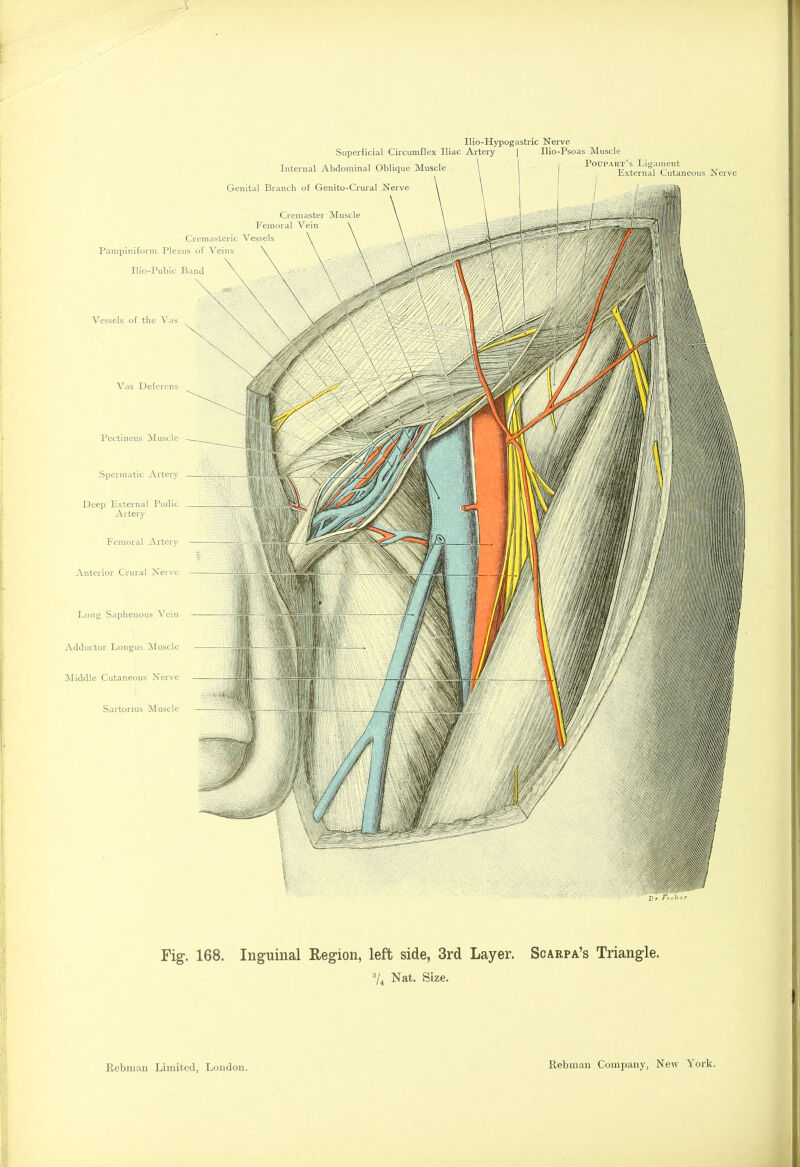 Vessels of the Vas Vas Deferens Pectineus Muscle Spermatic Artery Deep External Pudic Artery Femoral Artery Anterior Crural Nerve Long Saphenous Vein Adductor Longus Muscle Middle Cutaneous Nerve Sartorius Muscle Ilio-Hypogastric Nerve Superficial Circumflex Iliac Artery | Ilio-Psoas Muscle Internal Abdominal Oblique Muscle ^ 1 Pouiari s Ligament Genital Branch of Genito-Crural Nerve External Cutaneous Nerve Ilio-Pubic Band Cremaster Muscle Femoral Vein Cremasteric Vessels Pampiniform Plexus of Veins Fig. 168. Inguinal Region, left side, 3rd Layer. Scarpa’s Triangle. 3/4 Nat. Size.