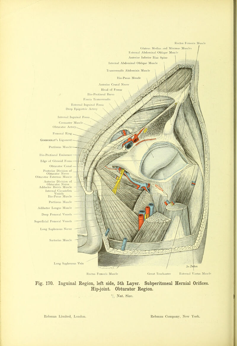 . Internal Inguinal Fossa Cremaster Muscle Obturator Artery Femoral Ring Gimbernat’s Ligament Sartorius Muscle Ilio-Psoas Muscle Anterior Crural Nerve Head of Femur Ilio-Pectineal Bursa Fascia Transversalis External Inguinal Fossa Deep Epigastric Artery Pectineus Long Saphenous Nerve Fig 170. Inguinal Region, left side, 5th Layer. Subperitoneal Hernial Orifices. Hip-joint. Obturator Region. 2/;i Nat. Size. Rectus Femoris Muscle Gluteus Medius and Minimus Muscles External Abdominal Oblique Muscle Anterior Inferior Iliac Spine Internal Abdominal Oblique Muscle Transversalis Abdominis Muscle Ilio-Pectineal Eminence Edge of Glenoid Fossa Obturator Canal Posterior Division of Obturator Nerve Obturator Externus Muscle Anterior Division of Obturator Nerve Adductor Brevis Muscle Internal Circumflex Vessels Ilio-Psoas Muscle Pectineus Muscle Adductor Longus Muscle Deep Femoral Vessels Superficial Femoral Vessels Great Trochanter External Vastus Muscle Long Saphenous Vein Rectus Femoris Muscle