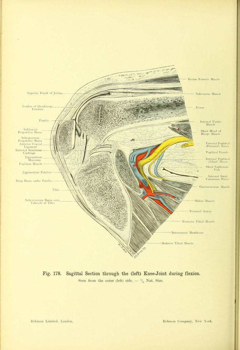 Rectus Femoris Muscle — Subcrureus Muscle Femur Internal Vastus Muscle Short Head of Biceps Muscle Soleus Muscle Peroneal Artery Posterior Tibial Muscle Interosseous Membrane ■Anterior Tibial Muscle Superior Pouch of Joint. Tendon of Q Extensor Patella Subfascial Prepatellar Bursa Subcutaneous Prepatellar Bursa Anterior Crucial Ligament External Semilunar Cartilage Ligamentum Mucosum Popliteus Muscle Ligamentum Patellae Deep Bursa under Patella Tibia Subcutaneous Bursa over. Tubercle of Tibia Gastrocnemius Muscle External Popliteal (Peroneal) Nerve Popliteal Vessels Internal Popliteal (Tibial) Nerve Short Saphenous Vein Internal Sural Cutaneous Nerve Fig. 178. Sagittal Section through the (left) Knee-Joint during flexion. Seen from the outer (left) side. — 3/i Nat. Size.