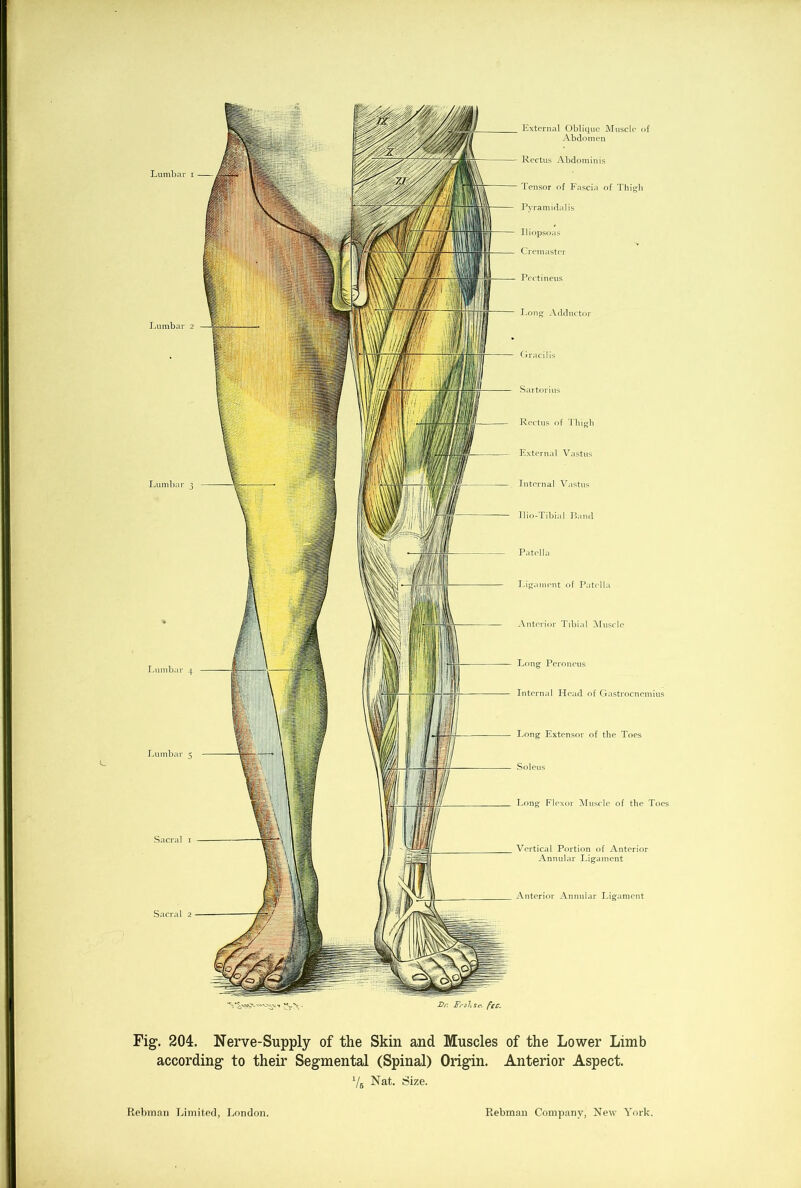 'S NNV-O-^V t . Dr. Frohst’, fee. Fig. 204. Nerve-Supply of the Skin and Muscles of the Lower Limb according to their Segmental (Spinal) Origin. Anterior Aspect. 7b Nat. Size. I Lumbar i Lumbar 2 Lumbar 3 I Lumbar 4 Lumbar 5 Sacral 1 Sacral 2 External Oblique Muscle of Abdomen Rectus Abdominis Tensor of Fascia of Thigh Pyramidalis Iliopsoas Cremaster Pectineus Long Adductor Gracilis Sartorius Rectus of Thigh External Vastus Internal Vastus Ilio-Tibial Band Patella Ligament of Patella Anterior Tibial Muscle Long Peroneus Internal Head of Gastrocnemius Long Extensor of the Toes Soleus Long Flexor Muscle of the Toes Vertical Portion of Anterior Annular Ligament \nterior Annular Ligament