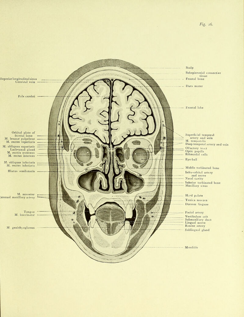 Orbital plate of frontal bone M. levator palpebrae M. rectus superioris M. obliquus superioris Lachrymal gland M. rectus externus M. rectus internus M. obliquus infeiioris M. rectus inferioris Hiatus semilunaris Superior longitudinal sinus Cerebral vein M. masseter [nternal maxillary aitery Tongue M. buccinator M. geniohyoglossus Scalp Subepicranial connective Frontal bone Dura mater Superficial temporal artery and vein M. temporalis Deep temporal artery ant Olfactory tract Optic papilla Ethmoidal cells Eye-ball Middle turbinated bone Infra-orbital artery and nerve Nasal cavity Inferior turbinated bone Maxillary sinus Hard palate Tunica mucosa Dorsum linguae Facial artery Vestibulum oris SubmaxilJary duct Lingual nerve Ranine artery Sublingual gland