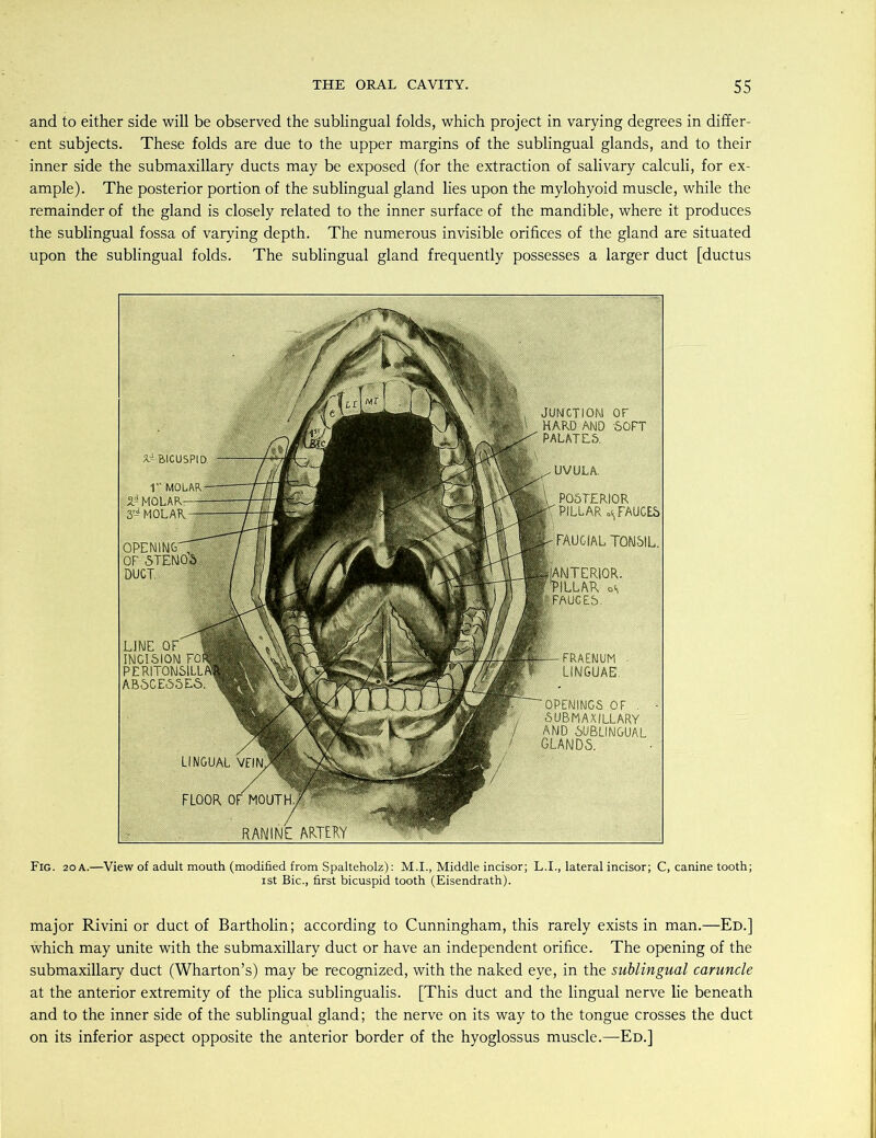 and to either side will be observed the sublingual folds, which project in varying degrees in differ- ent subjects. These folds are due to the upper margins of the sublingual glands, and to their inner side the submaxillary ducts may be exposed (for the extraction of salivary calculi, for ex- ample). The posterior portion of the sublingual gland lies upon the mylohyoid muscle, while the remainder of the gland is closely related to the inner surface of the mandible, where it produces the sublingual fossa of varying depth. The numerous invisible orifices of the gland are situated upon the sublingual folds. The sublingual gland frequently possesses a larger duct [ductus junction) or HARD AND SOFT PALATES X- BICUSPID. UVULA. I'- MOLAR- r MOLAR:—- 3- MOLAR — POSTERIOR 'PILLAR FAUCES ;faugial TONSIL. OPENING-^ OF STENOS DUCT. Interior. PILLAR os fAUGES. LJNE OF 1 INCISION FOfl PERITONSILLI ABSCESSES. FRAENUM LINGUAE. 'OPENINGS OF . SUBMAXILLARY AND SUBLINGUAL GLANDS. LINGUAL VEIN. FLOOR OF MOUTH. RANINE ARTERY Fig. 20 a.—View of adult mouth (modified from Spalteholz): M.I., Middle incisor; L.I., lateral incisor; C, canine tooth; ist Bic., first bicuspid tooth (Eisendrath). major Rivini or duct of Bartholin; according to Cunningham, this rarely exists in man.—Ed.] which may unite with the submaxillary duct or have an independent orifice. The opening of the submaxillary duct (Wharton’s) may be recognized, with the naked eye, in the sublingual caruncle at the anterior extremity of the plica sublingualis. [This duct and the lingual nerve lie beneath and to the inner side of the sublingual gland; the nerve on its way to the tongue crosses the duct on its inferior aspect opposite the anterior border of the hyoglossus muscle.—Ed.]