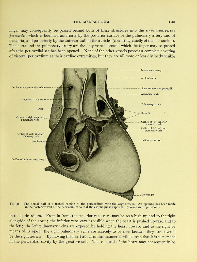 finger may consequently be passed behind both of these structures into the sinus transversus pericardii, which is bounded anteriorly by the posterior surface of the pulmonary artery and of the aorta, and posteriorly by the anterior wall of the auricles (consisting chiefly of the left auricle). The aorta and the pulmonary artery are the only vessels around which the finger may be passed after the pericardial sac has been opened. None of the other vessels possess a complete covering of visceral pericardium at their cardiac extremities, but they are all more or less distinctly visible Diaphragm Innominate artery Orifice of azygos major Superior vena cava— Orifice of right inferior pulmonary Sinus transversus pericardii Ascending aorta Pulmonary artery Bronchi of left superior vein Orifice of left inferior pulmonary vein Left vagus nerve Fig. 51.—The dorsal half of a frontal section of the pericardium with the large vessels. An opening has been made in the posterior wall of the pericardium so that the esophagus is exposed. (Formalin preparation.) in the pericardium. From in front, the superior vena cava may be seen high up and to the right alongside of the aorta; the inferior vena cava is visible when the heart is pushed upward and to the left; the left pulmonary veins are exposed by holding the heart upward and to the right by means of its apex; the right pulmonary veins are scarcely to be seen because they are covered by the right auricle. By moving the heart about in this manner it will be seen that it is suspended in the pericardial cavity by the great vessels. The removal of the heart may consequently be