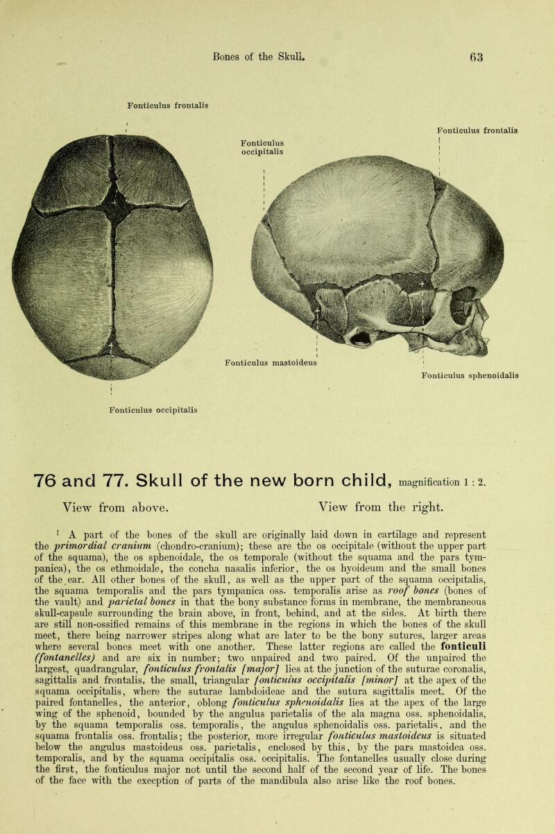 Fonticulus frontalis Fonticulus frontalis f I I Fonticulus sphenoidalis Fonticulus mastoideus Fonticulus occipitalis Fonticulus occipitalis 76 and 77. Skull of the new born child, magnification 1:2. View from above. View from the right. ' A part of the hones of the skull are originally laid down in cartilage and represent the primordial cranium (chondro-cranium); these are the os occipitale (without the upper part of the squama), the os sphenoidale, the os temporale (without the squama and the pars tym- panica), the os ethmoidale, the concha nasalis inferior, the os hyoideum and the small hones of the,ear. All other hones of the skull, as well as the upper part of the squama occipitalis, the squama temporalis and the pars tympanica oss. temporalis arise as roof bones (bones of the vault) and parietal hones in that the bony substance forms in membrane, the membraneous skull-capsule surrounding the brain above, in front, behind, and at the sides. At birth there are still non-ossified remains of this membrane in the regions in which the bones of the skull meet, there being narrower stripes along what are later to be the bony sutures, larger areas where several bones meet with one another. These latter regions are called the fonticuli (fontanelles) and are six in number; two unpaired and two paired. Of the unpaired the largest, quadrangular, fonticulus frontalis [major] lies at the junction of the suturae coronalis, sagittalis and frontalis, the small, triangular fonticulus occipitalis [minor] at the apex of the squama occipitalis, where the suturae lambdoideae and the sutura sagittalis meet. Of the paired fontanelles, the anterior, oblong fonticulus sphenoidalis lies at the apex of the large wing of the sphenoid, bounded by the angulus parietalis of the ala magna oss. sphenoidalis, by the squama temporalis oss, temporalis, the angulus sphenoidalis oss. parietalis, and the squama frontalis oss. frontalis; the posterior, more irregular fonticulus mastoideus is situated below the angulus mastoideus oss, parietalis, enclosed by this, by the pars mastoidea oss. temporalis, and by the squama occipitalis oss. occipitalis. The fontanelles usually close during the first, the fonticulus major not until the second half of the second year of life. The bones of the face with the execption of parts of the mandibula also arise like the roof bones.