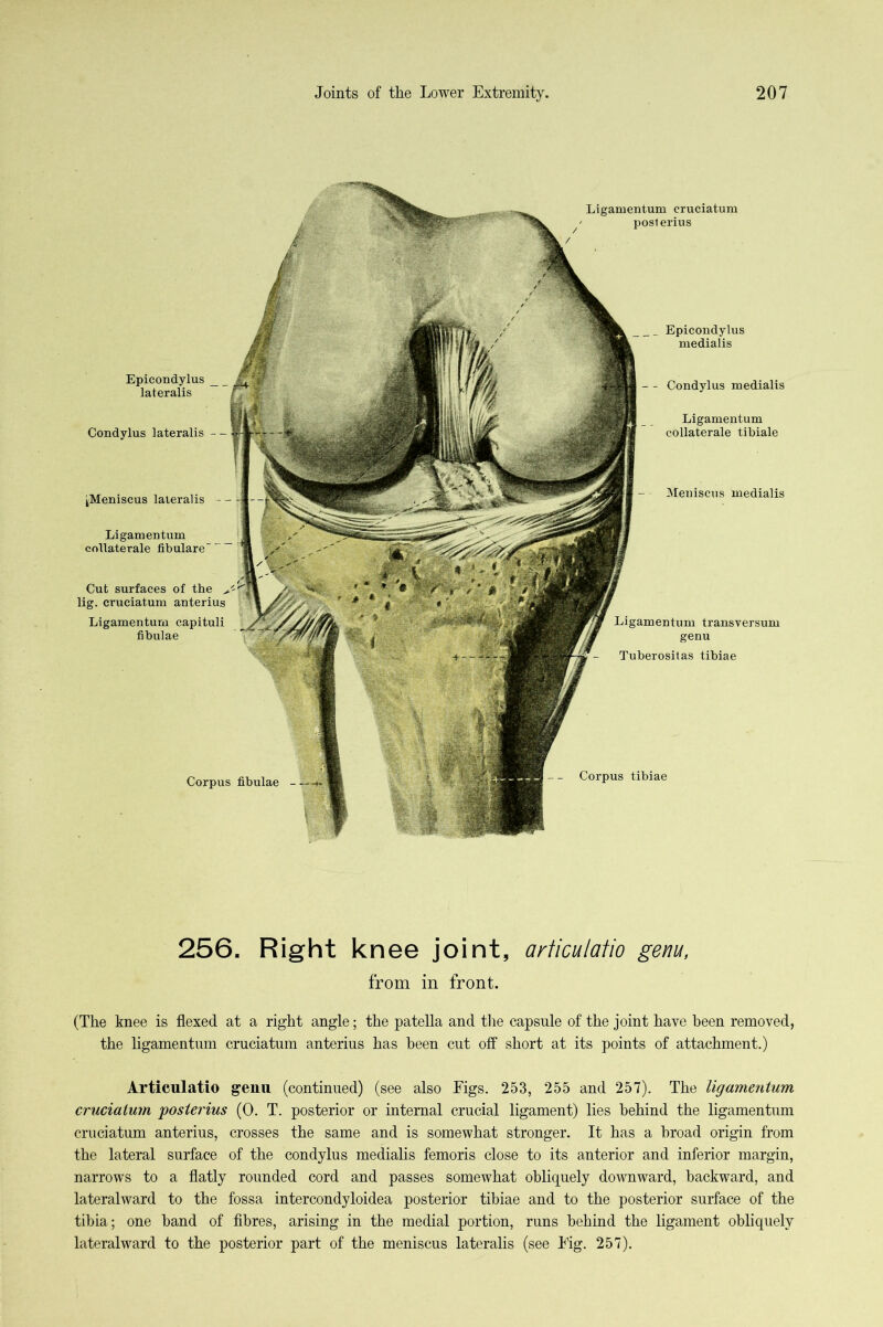 Ligamentum cruciatum posterius Ligamentum oollaterale fibulare Corpus fibulae - -- Corpus tibiae Epicoiidylus medialis - - Condylus medialis Ligamentum collaterale tibiale ^Meniscus lateralis - - Meniscus medialis Ligamentum transversum genu Tuberositas tibiae Epicondylus lateralis Condylus lateralis Cut surfaces of the lig. cruciatum anterius Ligamentum capituli fibulae 256. Right knee joint, articulafio genu, from in front. (The knee is flexed at a right angle; the patella and tlie capsule of the joint have been removed, the ligamentum cruciatum anterius has been cut off short at its points of attachment.) Articulatio genu (continued) (see also Eigs. 253, 255 and 257). The ligamentum cruciatum posterius (0. T. posterior or internal crucial ligament) lies behind the ligamentum cruciatum anterius, crosses the same and is somewhat stronger. It has a broad origin from the lateral surface of the condylus medialis femoris close to its anterior and inferior margin, narrows to a flatly rounded cord and passes somewhat obliquely downward, backward, and lateralward to the fossa intercondyloidea posterior tibiae and to the posterior surface of the tibia; one hand of fibres, arising in the medial portion, runs behind the ligament obliquely lateralward to the posterior part of the meniscus lateralis (see h'ig. 257).