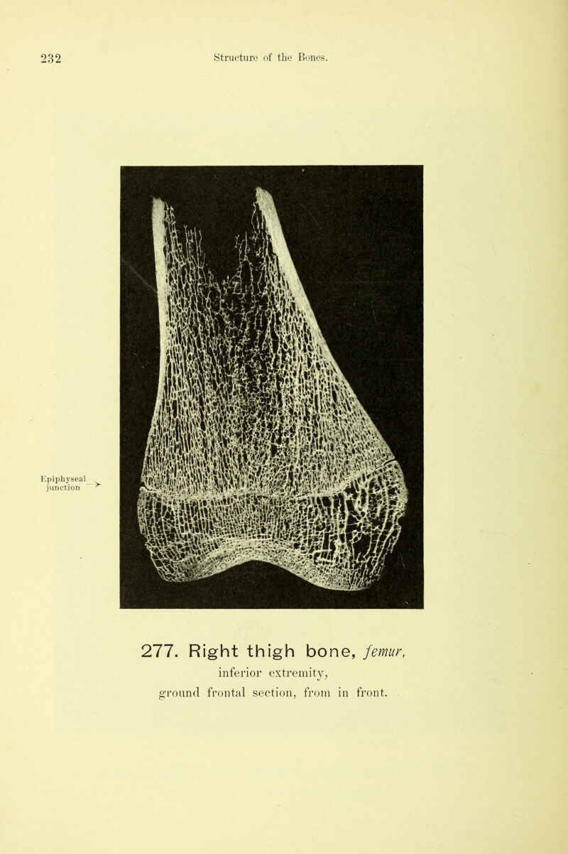 Epiphyseal_ junction ^ 277. Right thigh bone, femur, inferior extremity,