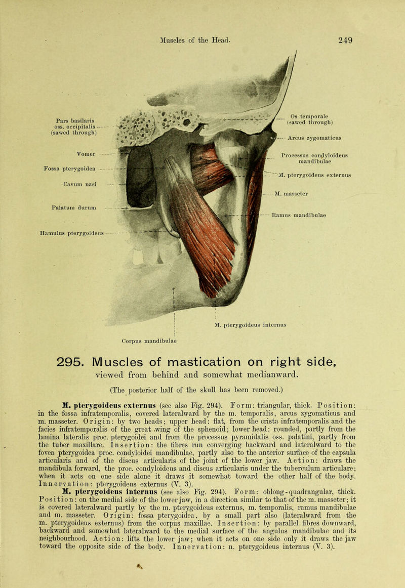 Pars basilaris oss. occipitalis - (sawed through) Vomer Fossa pterygoidea Cavum nasi Palatum durum Os temporale (sawed through) Arcus zygomaticus Processus conplyloideus mandibulae - ~~AI. pterygoideus externus M. masseter -- Eamus mandibulae Corpus mandibulae 295. Muscles of mastication on right side, viewed from behind and somewhat medianward. (The posterior half of the skull has been removed.) M. pterygoideus externus (see also Fig. 294). Form: triangular, thick. Position: in the fossa infratemporalis, covered lateralward by the m. temporalis, arcus zygomaticus and m. masseter. Origin: by two heads; upper head: flat, from the crista infratemporalis and the facies infratemporalis of the great .wing of the sphenoid; lower head: rounded, partly from the lamina lateralis proc. pterygoidei and from the processus pyramidalis oss. palatini, partly from the tuber maxillare. Insertion: the fibres run converging backward and lateralward to the fovea pterygoidea proc. condyloidei mandibulae, partly also to the anterior surface of the capsula articularis and of the discus articularis of the joint of the lower jaw. Action: draws the mandibula forward, the proc. condyloideus and discus articularis under the tuberculum articulare; when it acts on one side alone it draws it somewhat toward the other half of the body. Innervation: pterygoideus externus (Y. 3). M. pterygoideus internus (see also Fig. 294). Form: oblong-quadrangular, thick. Position: on the medial side of the lower jaw, in a direction similar to that of the m. masseter; it is covered lateralward partly by the m. pterygoideus externus, m. temporalis, ramus mandibulae and m. masseter. Origin: fossa pterygoidea, by a small part also (lateralward from the m. pterygoideus externus) from the corpus maxillae. Insertion: by parallel fibres downward, backward and somewhat lateralward to the medial surface of the angulus mandibulae and its neighbourhood. Action: lifts the lower jaw; when it acts on one side only it draws the jaw toward the opposite side of the body. Innervation: n. pterygoideus internus (Y. 3). Hamulus pterygoideus M. pterygoideus internus