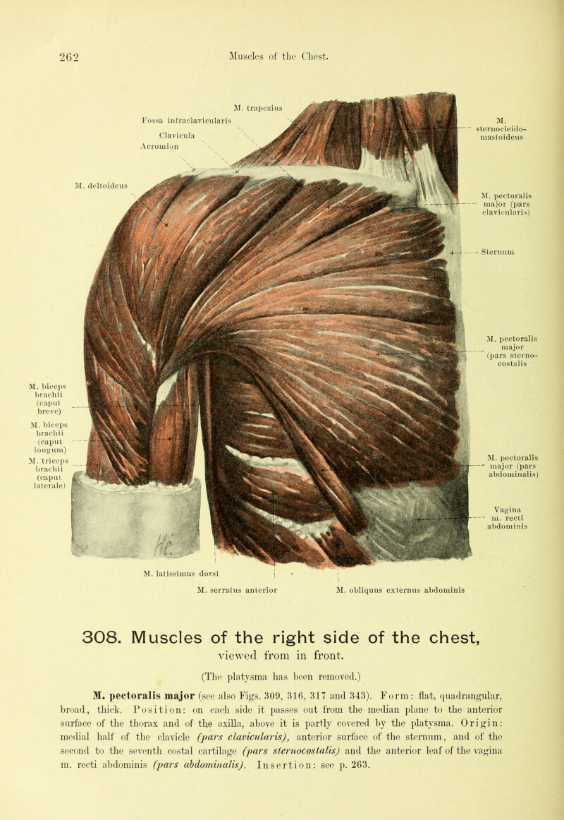 M. biceps brachii (caput breve) M. biceps brachii (caput Ion gum) M. triceps brachii (caput laterale) M. pectoralis major (pars stern o- costalis M. sternocleido- mastoideus M. pectoralis major (pars clavieularis) Sternum M. pectoralis major (pars abdominalis) Vagina m. recti abdominis M. trapezius Fossa infraclavicularis Clavicula Acromion M. deltoideus M. latissimus dorsi M. serratus anterior M. obliquus externus abdominis 308. Muscles of the right side of the chest, viewed from in front. (The platysma has been removed.) M. pectoralis major (see also Figs. 309, 316, 317 and 343). Form: flat, quadrangular, broad, thick. Position: on each side it passes out from the median plane to the anterior surface of the thorax and of the axilla, above it is partly covered by the platysma. Origin: medial half of the clavicle (pars clavieularis), anterior surface of the sternum, and of the second to the seventh costal cartilage (pars sternocostalis) and the anterior leaf of the vagina m. recti abdominis (pars abdominalis). Insertion: see p. 263.