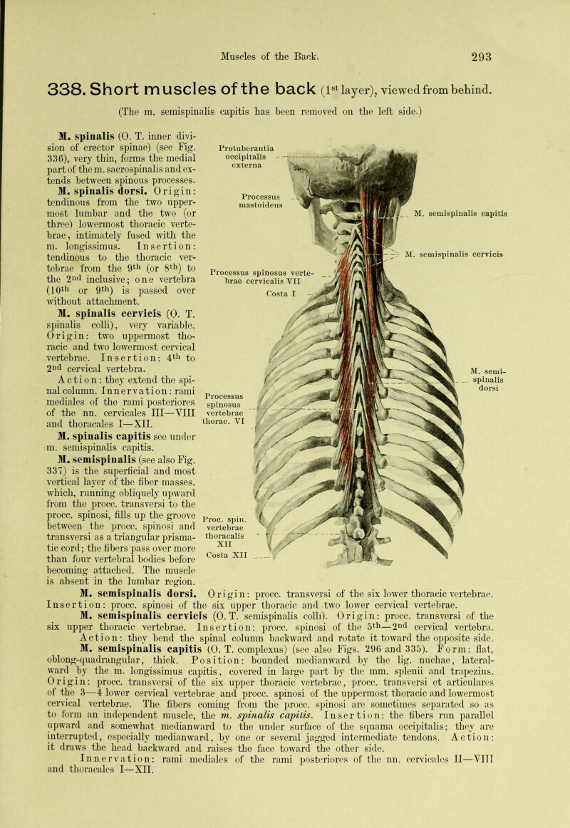 338. Short muscles of the beck (1st layer), viewed from behind. (The m. semispinalis capitis has been removed on the left side.) M. spinalis (0. T. inner divi- sion of erector spinae) (see Fig. 336) , very thin, forms the medial part of the m. sacrospinalis and ex- tends between spinous processes. M. spinalis dorsi. Origin: tendinous from the two upper- most lumbar and the two (or three) lowermost thoracic verte- brae, intimately fused with the in. longissimus. Insertion: tendinous to the thoracic ver- tebrae from the 9th (or 8th) to the 2nd inclusive; one vertebra (10th or 9th) is passed over without attachment. M. spinalis cervicis (0. T. spinalis colli), very variable. Origin: two uppermost tho- racic and two lowermost cervical vertebrae. Insertion: 4th to 2nd cervical vertebra. Action : they extend the spi- nal column. Innervation: rami mediales of the rami posteriores of the nn. cervicales III—VIII and thoracales I—XII. M. spinalis capitis see under m. semispinalis capitis. M. semispinalis (see also Fig. 337) is the superficial and most vertical layer of the fiber masses, which, running obliquely upward from the procc. transversi to the procc. spinosi, fills up the groove between the procc. spinosi and transversi as a triangular prisma- tic cord; the fibers pass over more than four vertebral bodies before becoming attached. The muscle is absent in the lumbar region. M. semispinalis dorsi. Origin: procc. transversi of the six lower thoracic vertebrae. Insertion: procc. spinosi of the six upper thoracic and two lower cervical vertebrae. M. semispinalis cervicis (0. T. semispinalis colli). Origin: procc. transversi of the six upper thoracic vertebrae. Insertion: procc. spinosi of the 5th—2nd cervical vertebra. Action: they bend the spinal column backward and rotate it toward the opposite side. M. semispinalis capitis (0. T. complexus) (see also Figs. 296 and 335). Form: flat, oblong-quadrangular, thick. Position: bounded medianward by the lig. nuchae, lateral- ward by the m. longissimus capitis, covered in large part by the mm. splenii and trapezius. Origin: procc. transversi of the six upper thoracic vertebrae, procc. transversi et articulares of the 3—4 lower cervical vertebrae and procc. spinosi of the uppermost thoracic and lowermost cervical vertebrae. The fibers coming from the procc. spinosi are sometimes separated so as to form an independent muscle, the m. spinalis capilis. Insertion: the fibers run parallel upward and somewhat medianward to the under surface of the squama. occipitalis; they are interrupted, especially medianward, by one or several jagged intermediate tendons. Action: it draws the head backward and raises the face toward the other side. Innervation: rami mediales of the rami posteriores of the nn. cervicales II—VIII and thoracales I—XII. Protuberantia occipitalis externa Processus mastoideus L_ M. semispinalis capitis Processus spinosus verte- brae cervicalis VII Proc vertebrae tboracalis ~ *7 xii r/