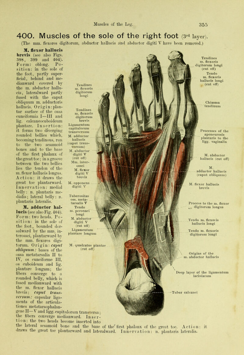 400. Muscles of the sole of the right foot (3rd layer). (The mm. flexores digitorum, abductor hallucis and abductor digiti V have been removed.) M. flexor hallucis brevis (see also Figs. 398, 399 and 404). Form: oblong. Po- sition: in the sole of the foot, partly super- ficial, behind and me- dianward covered by the m. abductor hallu- cis, lateralward partly fused with the caput obliquum m. adductoris hallucis. Origin:plan- tar surface of the ossa cuneiformia I—III and lig. calcaneocuboideum plan tare. Insertion: it forms two diverging rounded bellies which, becoming tendinous, run to the two sesamoid bones and to the base of the first phalanx of the great toe; in a groove between the two bellies lies the tendon of the m. flexor hallucis longus. Action: it draws the great toe plantarward. Innervation: medial belly: n. plantaris me- dialis; lateral belly: n. plantaris lateralis. M. adductor hal- lucis (see also Fig. 404). Form: two heads. Po- sition: in the sole of the foot, bounded dor- sal ward by the mm, in- terossei, plantarward by the mm. flexores digi- torum. Origin: caput obliquum: bases of the ossa metatarsalia II to IV, os cuneiforme III, os cuboideum and lig. plantare longum; the fibers converge to a rounded belly, which is fused medianward with the m. flexor hallucis brevis; caput trans- versum: capsular liga- ments of the articula- tiones metatarsophalan- geae II V and ligg. capitulorum transversa; the fibers converge medianward. Inser- tion: the two heads become inserted into the lateral sesamoid bone and the base of thec draws the great toe plantarward and lateralward Tendines m. flexoris digitorum longi Tendines m. flexoris digitorum brevis Ligamentum capitulorum transversum M. adductor hallucis (caput trans- versum) M. abductor digiti V (cut off) Mm. inter- ossei M. flexor digiti V brevis M. opponens _ digiti V Tuberositas oss. meta- tarsalis V Tendo m. peronaei ' longi M. abductor*- digiti V (cut off) Ligamentum plantare longum M. quadratus plantae _ (cut off) Tendines m. flexoris digitorum longi (cut off) Tendo m. flexoris hallucis longi (cut off) Chi asm a tendiuum Processes of the aponeurosis plantaris to the ligg. vaginalia M. abductor hallucis (cut off) M. adductor hallucis (caput obliquum) M. flexor hallucis brevis Process to the m. flexor digitorum longus Tendo m. flexoiis hallucis longi Tendo m. flexoris digitorum longi Origins of the m. abductor hallucis Deep layer of the ligamentum laciniatum -Tuber calcanei first phalanx of the great toe. Action Innervation: n. plantaris lateralis.