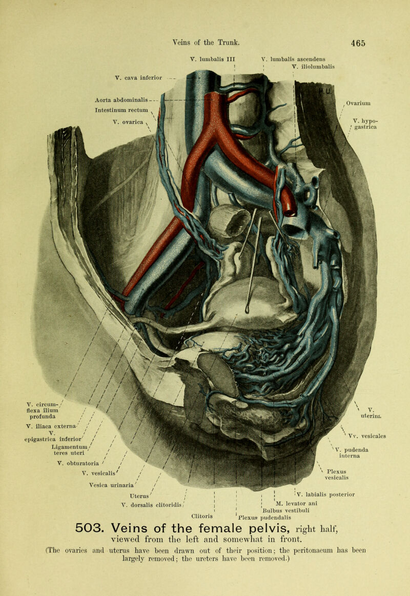 Y. lumbalis III V. lumbalis ascendens 1 ' V. iliolumbalis t Ovarium Y. hypo- gastrica V. cava inferior — Aorta abdominalis - - Intestinum rectum V. ovarica V. circum-/ flex a ilium profunda / V. iliaca externa/' Y. epigastrica inferior7 Ligamentum/ ' teres uteri ' / / Y. obturatoria 1 / i ' Y. vesicalis' > Vesica urinaria7 Uterus' \ ' V. uterina ' Yv. vesicates N V. pudenda interna v Plexus vesicalis ’V. labialis posterior Y. dorsalis clitoridis/ Clitoris i i M. levator ani Bulbus vestibuli Plexus pudendalis 503. Veins of the female pelvis, right half, viewed from the left and somewhat in front. (The ovaries and uterus have been drawn out of their position; the peritonaeum has been largely removed; the ureters have been removed.)