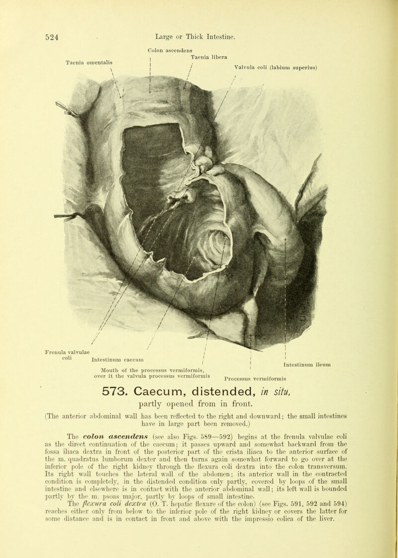 Colon ascendens Taenia omentalis \ \ Frenula valvulae coli Intestinnm caecum Taenia libera j Valvilla coli (labium superius) / / / - Intestinnm ileum Mouth of the processus verraiformis, over it the valvula processus vermiformis Processus vermiformis 573. Caecum, distended, in situ, partly opened from in front. (The anterior abdominal waU has been reflected to the right and downward; the small intestines have in large part been removed.) The colon ascendens (see also Figs. 589—592) begins at the frennla valvnlae coli as the direct continuation of the caecum; it passes upward and somewhat backw^ard from the fossa iliaca dextra in front of the posterior part of the crista iliaca to the anterior surface of the m. quadratus lumborum dexter and then turns again somewhat forward to go over at the inferior pole of the right kidney through the flexura coli dextra into the colon transversum. Its right wall touches the lateral wall of the abdomen; its anterior wall in the contracted condition is completely, in the distended condition only partly, covered by loops of the small intestine and elsewhere is in contact with the anterior abdominal wall; its left wall is bounded partly by the m. psoas major, partly by loops of small intestine. The flexura coli dextra (0. T. hepatic flexure of the colon) (see Figs. 591, 592 and 594) reaches either only from below to the inferior pole of the right kidney or covers the latter for some distance and is in contact in front and above with the impressio colica of the liver.