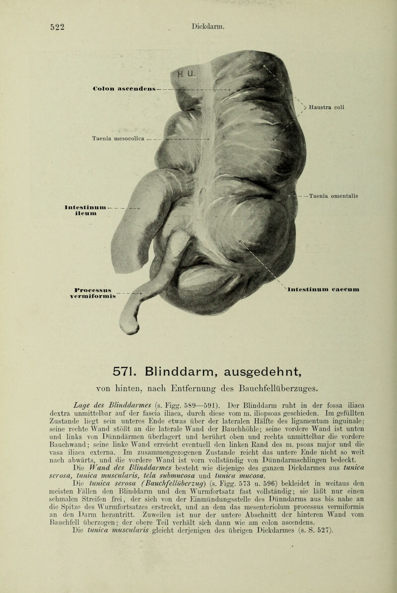 Colon ascendens Taenia mesocolica Intestinum ileum Processns vermiformis Nlntestinum caecnm —Taenia omentalis 571. Blinddarm, ausgedehnt, von hinten, nach Entfernung des Bauchfellüberzuges. Lage des Blinddarmes (s. Figg. 589—591). Der Blinddarm ruht in der fossa iliaca dextra unmittelbar auf der fascia iliaca, durch diese vom m. iliopsoas geschieden. Im gefüllten Zustande liegt sein unteres Ende etwas über der lateralen Hälfte des ligamentum inguinale: seine rechte Wand stößt an die laterale Wand der Bauchhöhle; seine vordere Wand ist unten und links von Dünndärmen überlagert und berührt oben und rechts unmittelbar die vordere Bauchwand; seine linke Wand erreicht eventuell den linken Rand des m. psoas major und die vasa iliaca externa. Im zusammengezogenen Zustande reicht das untere Ende nicht so weit nach abwärts, und die vordere Wand ist vorn vollständig von Dünndarmschlingen bedeckt. Die Wand des Blinddarmes besteht wde diejenige des ganzen Dickdarmes aus tunica serosa, tunica muscularis, tela submucosa und tunica mucosa. Die tunica serosa (Bauchfellüberzug) (s. Figg. 573 u. 596) bekleidet in weitaus den meisten Fällen den Blinddarm und den Wurmfortsatz fast vollständig; sie läßt nur einen schmalen Streifen frei, der sich von der Einmündungsstelle des Dünndarms aus bis nahe an die Spitze des Wurmfortsatzes erstreckt, und an dem das mesenteriolum processus vermiformis an den Darm herantritt. Zuweilen ist nur der untere Abschnitt der hinteren Wand vom Bauchfell überzogen; der obere Teil verhält sich dann wie am colon ascendens. Die tunica muscularis gleicht derjenigen des übrigen Dickdarmes (s. S. 527).