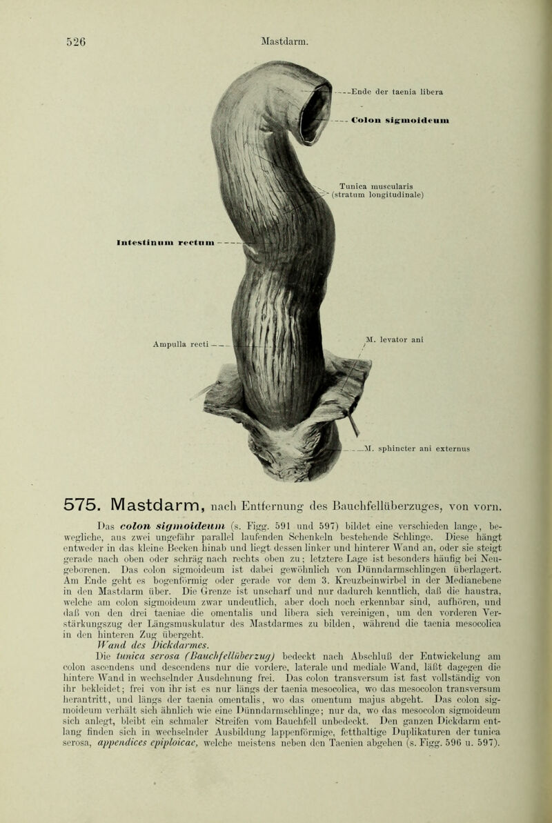 Ende der taenia libera Colon sigrmoidfiim M. sphincter ani externus Intestinum rertnni Tuuiea muscularis (stratum longitudinale) Ampulla reeti M. levator ani / 575. Mastdarm, nach Entfernung des Bauchfelliiberzuges, von vorn. Das colon sigmoideum (s. Figg. 591 und 597) bildet eine verschieden lange, be- wegliche, aus zwei ungefähr parallel laufenden Schenkeln bestehende Schlinge. Diese hängt entweder in das kleine Becken hinab und liegt dessen linker und hinterer Wand an, oder sie steigt gerade nach oben oder schräg nach rechts oben zu; letztere Lage ist besonders häufig bei Neu- geborenen. Das colon sigmoideum ist dabei gewöhnlich von Dünndarmschlingen überlagert. Am Ende geht es bogenförmig oder gerade vor dem 3. Kreuzbeinwirbel in der Medianebene in den Mastdarm über. Die Grenze ist unscharf und nur dadurch kenntlich, daß die haustra, welche am colon sigmoideum zwar undeutlich, aber doch noch erkennbar sind, aufhören, und daß von den drei taeniae die omentalis und libera sich vereinigen, um den vorderen Ver- stärkungszug der Längsmuskulatur des Mastdarmes zu bilden, während die taenia mesocolica in den hinteren Zug übergeht. Wand des Dickdarmes. Die tunica serosa (Bauchfellüberzug) bedeckt nach Abschluß der Entwickelung am colon ascendens und descendens nur die vordere, laterale und mediale Wand, läßt dagegen die hintere Wand in wechselnder Ausdehnung frei. Das colon transversum ist fast vollständig von ihr bekleidet; frei von ihr ist es nur längs der taenia mesocolica, wo das mesocolon transversum heran tritt, und längs der taenia omentalis, wo das omentum majus abgeht. Das colon sig- moideum verhält sich ähnlich wie eine Dünndarmschlinge; nur da, wo das mesocolon sigmoideum sich anlegt, bleibt ein schmaler Streifen vom Bauchfell unbedeckt. I >en ganzen Dickdarm ent- lang finden sich in wechselnder Ausbildung lappenförmige, fetthaltige Duplikaturen der tunica serosa, appendices epiploicae, welche meistens neben den Taenien abgehen (s. Figg. 590 u. 597).