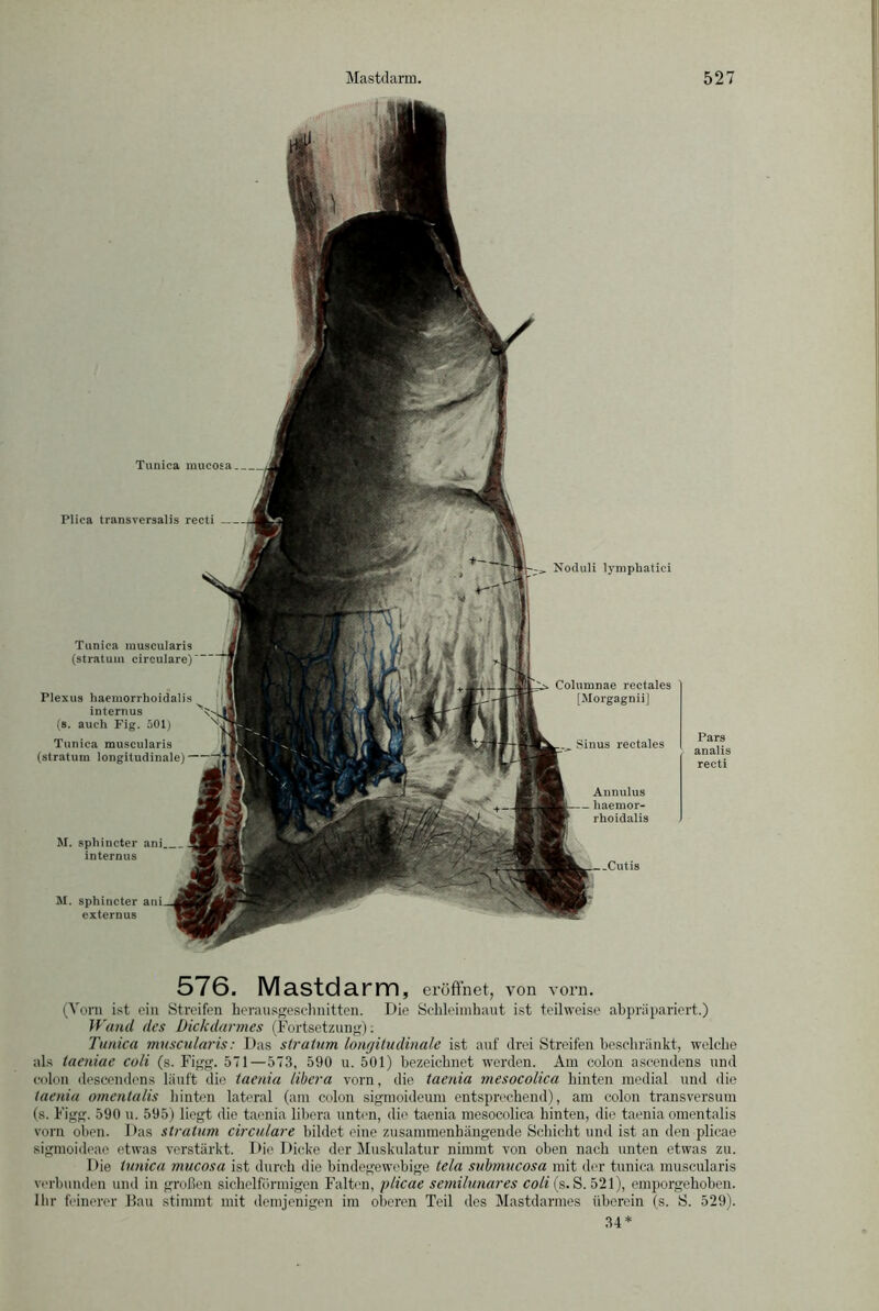 Tunica mucosa Plica transversalis recti Tunica muscularis (stratum circulare) Plexus haemorrhoidalis internus (s. auch Fig. 501) Tunica muscularis (stratum longitudinale) M. sphincter ani internus M. sphincter externus Annulus - haemor- rhoidalis Noduli lymphatici Columnae rectales [Morgagnii] Sinus rectales Pars analis recti 576. Mastdarm, eröffnet, von vorn. (Vorn ist ein Streifen herausgeschnitten. Die Schleimhaut ist teilweise abpräpariert.) Wand des Dickdarmes (Fortsetzung): Tunica muscularis: Das stratum longitudinale ist auf drei Streifen beschränkt, welche als taeniae coli (s. Figg. 571—573, 590 u. 501) bezeichnet werden. Am colon ascendens und colon descendens läuft die taenia libera vorn, die taenia mesocolica hinten medial und die taenia omentalis hinten lateral (am colon sigmoideum entsprechend), am colon transversum (s. Figg. 590 u. 595) liegt die taenia libera unten, die taenia mesocolica hinten, die taenia omentalis vorn oben. Das stratum circulare bildet eine zusammenhängende Schicht und ist an den plicae sigmoideae etwas verstärkt. Die Dicke der Muskulatur nimmt von oben nach unten etwas zu. Die tunica mucosa ist durch die bindegewebige tela submucosa mit der tunica muscularis verbunden und in großen sichelförmigen Falten, plicae semilunares coli (s. S. 521), emporgehoben. Ihr feinerer Bau stimmt mit demjenigen im oberen Teil des Mastdarmes überein (s. S. 529). 34*