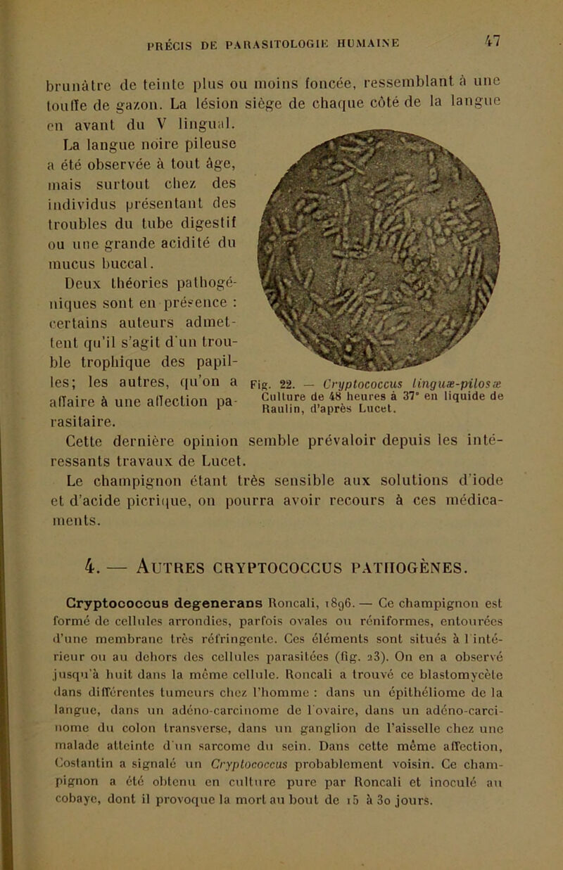 brunâtre de teinte plus ou moins foncée, ressemblant A une lonlle de ga/on. La lésion siège de chaque côté de la langue en avant du V linguid. La langue noire pileuse a été observée à tout âge, mais surtout chez des individus présentant des troubles du tube digestif ou une grande acidité du mucus buccal. Deux théories palhogé- niques sont en présence : certains auteurs admet- tent qu’il s’agit d'un trou- ble trophique des papil- les; les autres, qu’on a affaire à une affection pa- rasitaire. Cette dernière opinion semble prévaloir depuis les inté- ressants travaux de Lucet. Le champignon étant très sensible aux solutions d’iode Fig. 22. — Cnjptococcus linguæ-pilosæ Culture de 48 heures à 37” en liquide de Raulin, d’après Lucet. et d’acide picriipie, on pourra avoir recours à ces médica- ments. 4. — Autres cryptococcus patrogènes. Gryptocoocus degenerans Roncali, i8g6.— Ce champignon est formé de cellules arrondies, parfois ovales on rcniformes, entourées il’iine membrane très réfringente. Ces éléments sont situés à l'inté- rieur ou au dehors des cellules parasitées (fig. aS). On en a observé .jusqu'à huit dans la meme cellule. Roncali a trouvé ce blastomycète dans différentes tumeurs chez l’homme : dans un épithéliome de la langue, dans un adéno-carcinome de l'ovaire, dans un adéno-carci- nome du colon transverse, dans un ganglion de l’aisselle chez une malade atteinte d'un sarcome du sein. Dans cette même alfection, Coslantin a signalé un Cryptococcus probablement voisin. Ce cham- pignon a été obtenu en culture pure par Roncali et inoculé au cobaye, dont il provoque la mort au bout do i5 à 3o jours.