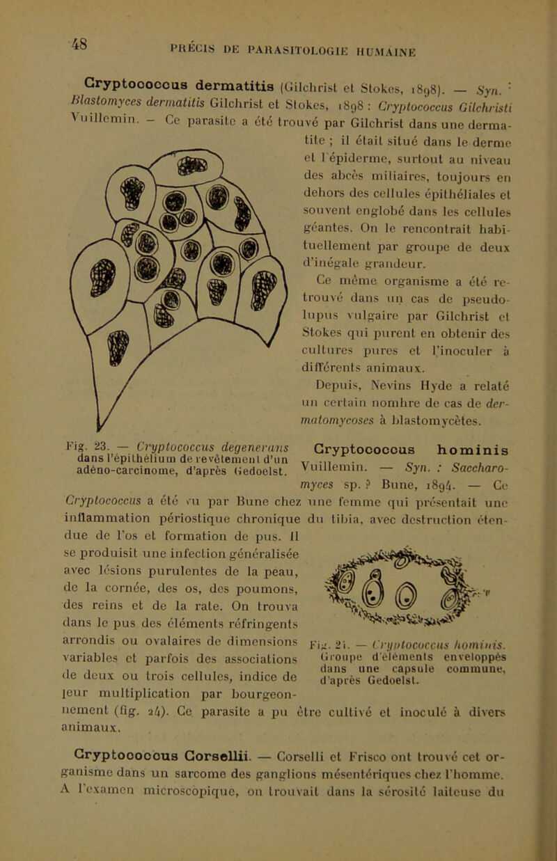 PKECIS DE PARASITOLOGIE IIUMALNE Gryptooocous dermatitis (Gilchrisl et Stokes, 1898). — Syn. ' Blastomyccs dermatitis Gilchrist et Slokcs, .898 : Cryplococcus Gilchristi Viiillemin. - Ce parasite a cto trouvé par Gilchrist dans une derma- tite ; il était situé dans le derme et 1 épiderme, surtout au niveau des abcès miliaires, toujours en dehors des cellules épithéliales et souvent englobé dans les cellules géantes. On le rencontrait habi- tuellement par groupe de deux d’inégale grandeur. Ce même organisme a été re- trouvé dans un cas de pseudo- lupus vulgaire par Gilchrist et Stokes qui inirent en obtenir des cultures pures et l’inoculer à dilïérents animaux. Depuis, Nevins Hyde a relaté un certain nombre de cas de der- matomycoses à blastomycètes. l'ig. 23. — Cryplococcus degenerans Gryptooocous hominis dans l’épithélium de revôtemenl d’un t, . adéno-carcinome, d’après Gedoolst. Viuüemin. oyn. : Sacenaro- myces sp. ? Bune, i8g4. — Ce Cryplococcus a été m par Bune cliez une femme qui présentait une inflammation périostique chronique du tibia, avec destruction éten- due de l’os et formation de pus. Il se produisit une infection généralisée avec lésions purulentes do la peau, de la cornée, des os, des poumons, dos reins et de la rate. On trouva clans le pus des éléments réfringents arrondis ou ovalaires de dimensions variables et parfois des associations de deux ou trois cellules, indice de leur multiplication par bourgeon- Fii!. 2i. — Cnjolocuccus hominis. Gi'oupe d'é'lèmenis enveloppés dans une capsule commune, d’après Gedoelst. nement (fig. aé). Ce parasite a iju être cultivé et inoculé à divers animaux. Gryptoooobua Gorsellii. — Corselli et Frisco ont trouvé cet or- ganisme dans un sarcome des ganglions mésentériques chez l’homme. A 1 c.xamcn microscopique, ou trouvait dans la sérosilé lailcusc du