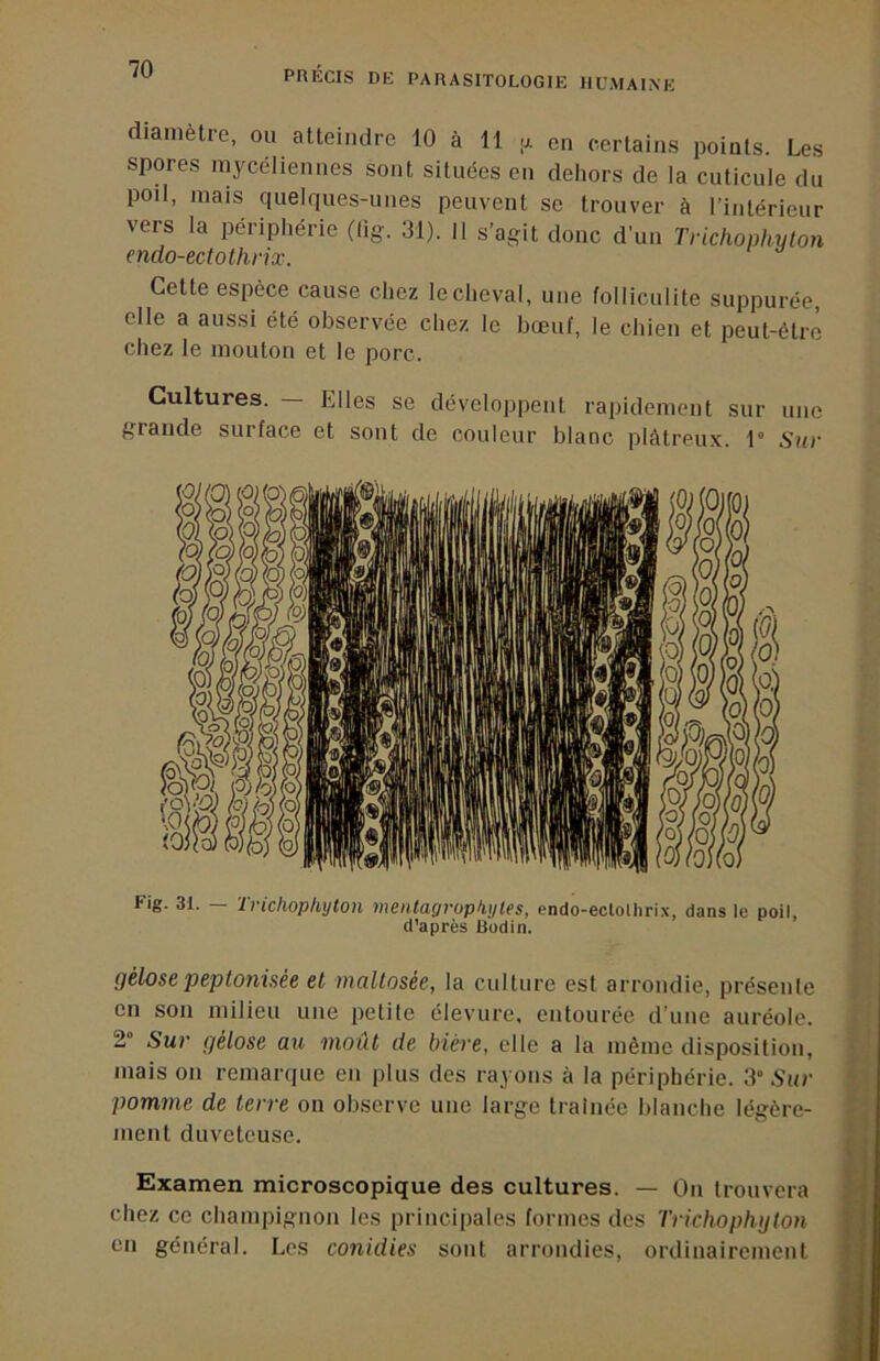 diamètre, ou atteindre 10 à 11 |x en certains points. Les spores mycéliennes sont situées en dehors de la cuticule du poil, mais c|uelques-unes peuvent se trouver à rinlérienr vers la périphérie (lig. 31). 11 s’agit donc d’un Trichonhvton mdo-ectothrix. Cette espèce cause chez le cheval, une folliculite suppurée, elle a aussi été observée chez le bœuf, le chien et peut-être chez le mouton et le porc. Cultures. — Elles se développent rapidement sur une grande surface et sont de couleur blanc plâtreux. 1° Sur Fig. 31. Ivichoplujton meittagvopliytes, endo-eclolhrix, dans le poil, d’après Budin. gélose peptonisée et maltosée, la culture est arrondie, présente \\ en son milieu une petite élevure, entourée d’une auréole. J | 2“ Sur gélose au moût de bière, elle a la même disposition, * mais on remarque en plus des rayons à la périphérie. 3° Sur pomme de terre on observe une large traînée blanche légère- ment duveteuse. Examen microscopique des cultures. — On trouvera chez ce champignon les principales formes des Trkhophglon en général. Les conidies sont arrondies, ordinairement