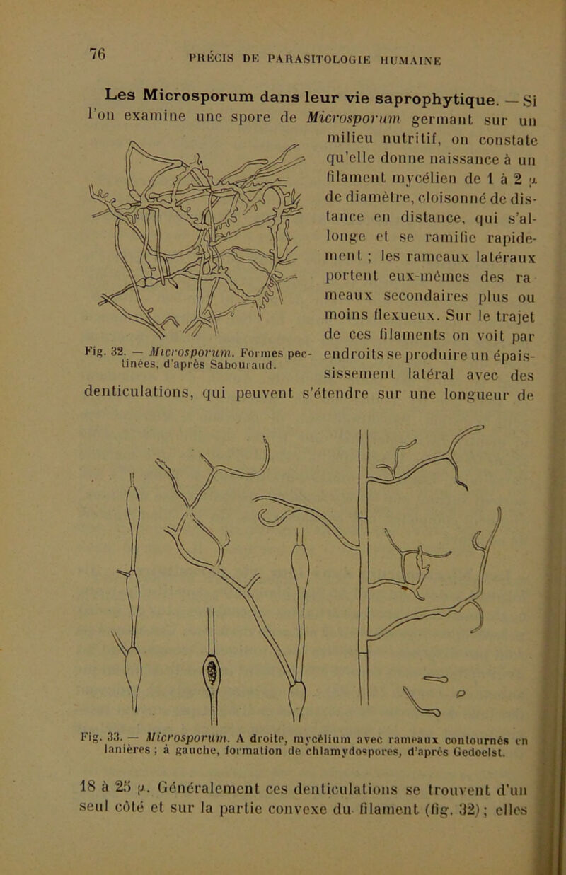 Les Microsporum dans leur vie saprophytique. — Si 1 on examine une spore de Microsporum germant sur un milieu nutritif, on constate qu’elle donne naissance à un lilament mycélien de 1 à 2 a de diamètre, cloisonné de dis- tance en distance, qui s’al- longe et se ramilie rapide- ment ; les rameaux latéraux portent eux-mêmes des ra meaux secondaires plus ou moins llexueux. Sur le trajet de ces filaments on voit paï- en d ro i ts se p rod uire u n épa i s- sissemenl latéral avec des denticulations, qui peuvent s’étendre sur une longueur de Fig. 32. — Microsporum. Formes pec linées, d’après Sabouraiid. 18 à 2î) IJ. Généralement ces denticulations se trouvent d’un seul côté et sur la partie convexe du filament (tig. 32); elles