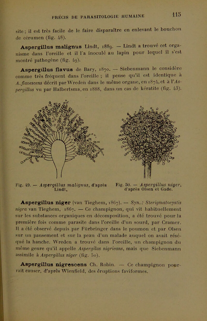 site ; il est très facile de le faire disparaître en enlevant le bouchon de cérumen (fig. 48). Aspergillus malignus Lindt, i88g. — Lindt a trouvé cet orga- nisme dans l’oreille et il l'a inoculé au lapin pour lequel il s’est montré pathogène (fig. ig). Aspergillus flavus de Bary, 1870. — Siebenmann te considère comme très fréquent dans l’oreille ; il pense qu’il est identique à A.Jlavescens décrit parWreden dans le meme organe, en 187/1,0! à l’As- pergillus vu par Halbertsma, en 1888, dans un cas de kératite (fig. 43). Aspergillus niger (van Tieghem, 1867). — Syn.: Sterigmalncystis nigra van Tieghem, 1867. — Ce champignon, qui vit habituellement sur les substances organiques en décomposition, a été trouvé pour la première fois comme parasite dans l’oreille d’un sourd, par Cramer. Il a été observé depuis par Fürbringer dans le poumon et par Olsen sur un pansement et sur la peau d’un malade auquel on avait résé- qué la hanche. AVreden a trouvé dans l’oreille, un champignon du même genre qu’il appelle Aspergiliis nigricans, mais que Siebenmann assimile k Aspergillus niger (lîg. 5o). Aspergillus nigrescens Ch. Robin. — Ce champignon pour- rait causer, d’après Wienfîeld, des éruptions faviformes.