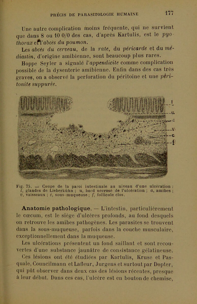Une autre complication moins fréquente, qui ne survient que dans 8 ou 10 0/0 des cas, d’après Kartulis, est le pyo- thorax efl’abcès du poumon. Les abcès du cerneau, de la rate, du péricarde et du mé- diaslin, d’origine amibienne, sont beaucoup plus rares. Hoppe Seyler a signalé l’appendicite comme complication possible de la dysenterie amibienne. Enfin dans des cas très graves, on a observé la perforation du péritoine et une péri- tonite suppurêe. Fig. 73. — Coupe de la pai'Oi intestinale au niveau d’une ulcération ; l, glandes de Lieberkûhn ; w, bord nécrosé de l’ulcération ; a, amibes ; V, vaisseaux ; c, sous-muqueuse; /’, follicule clos. Anatomie pathologique. — L’intestin, particulièrement le cæcum, est le siège d’ulcères profonds, au fond desquels on retrouve les amibes pathogènes. Les parasites se trouvent dans la sous-muqueuse, parfois dans la couche musculaire, exceptionnellement dans la muqueuse. Les ulcérations présentent un fond saillant et sont recou- vertes d’une substance jaunâtre de consistance gélatineuse. Ces lésions ont été étudiées par Kartulis, Kruse et Pas- quale, Councilmann etLadeur, Jurgens et surtoutpar Dopter, qui pût observer dans deux cas des lésions récentes, presque à leur début. Dans ces cas, l’ulcère est en bouton de chemise.