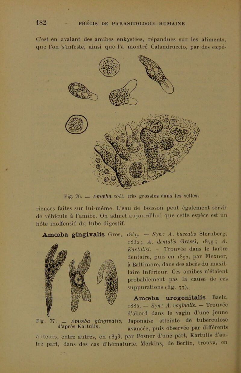 G’cst en avalant des amibes enkystées, répandues sur les aliments, que l’on 's’infeste, ainsi que l’a montré Calandrnccio, par des expé- Fig. 76. — Amæba coU, très grossies dans les selles. riences faites sur lui-même. L’eau de boisson peut également servir aujourd’hui que cette espèce est un de véhicule à l’amibe. On admet hôte inoffensif du tube digestif. Amæba gingivalis Gros, Fig. 77. — Amæba gingivalis, d’après Karlulis. iSèg. — Syn: A. buccalis Steridierg, 1862; A. denlalis Grassi, 1879; A. Kartulisi. - Trouvée dans le tartre dentaire, puis en 1892, par Flexncr, à Baltimore, dans des abcès du maxil- laire inférieur. Ces amibes n’étaient probablement pas la cause de ces suppurations (fig. 77). Amæba urogenitalis Baelz, i885. — Syn: A. vaginalis. - Trouvée d’abord dans le vagin d’une jeune Japonaise atteinte de tuberculose avancée, puis observée par différents auteurs, entre autres, en 1898, par Posner d'une part, Kartulis d au- tre part, dans des cas d’hématurie. Merkins, de Berlin, trouva, en t