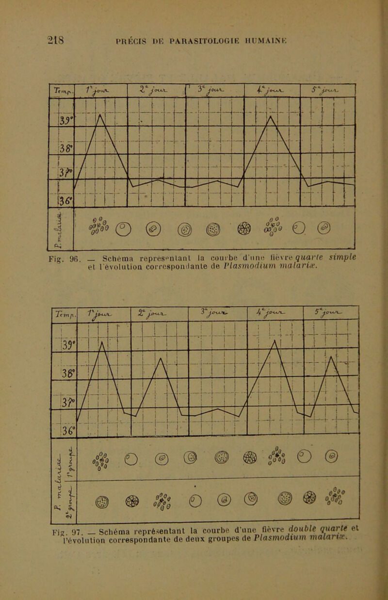 Fig. 96. — Schéma représentant la com be d'une lièvre guor/e simple et l'évolution correspondante de Plasmodium matariæ. Te (yrxfx Fig 97 —Schéma représentant la courbe d’une fiestt double quarte l’évolution correspondante de deux groupes de Plasmodium malarux.