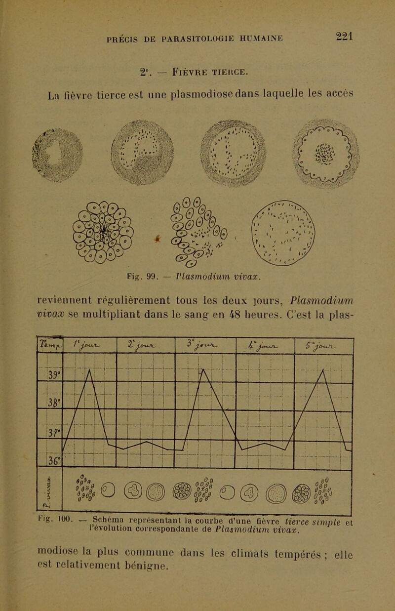 2”. — Fièvre tierce. La lièvre tierce est une plasmodiosedans laquelle les accès Fig. 99. — Plasmodium vivax. reviennent régulièrement tous les deux jours, Plasmodium vivax se multipliant dans le sang en 48 heures. C’est la plas- Fig. 100. _ Schéma représenlanl la courbe d’une' fièvre tierce simple et l’évolution correspondante de Plasmodium vivax. modiose la plus commune dans les climats tempérés; elle est relativement bénigne.