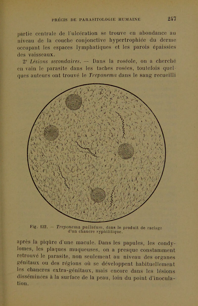 partie centrale de l'ulcéralion se trouve en abondance au niveau de la couche conjonctive hypertrophiée du derme occupant les espaces lymphatiques et les parois épaissies des vaisseaux. 2° Lésions secondaires. — Dans la roséole, on a cherché en vain le parasite dans les taches rosées, toutefois quel- ques auteurs ont trouvé le Treponema dans le sang recueilli après la piqûre d’une macule. Dans les papules, les condy- lomes, les plaques muqueuses, on a presque constamment retrouvé le parasite, non seulement au niveau des organes génitaux ou des régions où se développent habituellement les chancres extra-génitaux, mais encore dans les lésions disséminées à la surface de la peau, loin du point d’inocula- tion. — Treponema palluium, dans te produit de raclage d’un chancre syphilitique. Fig. 122.