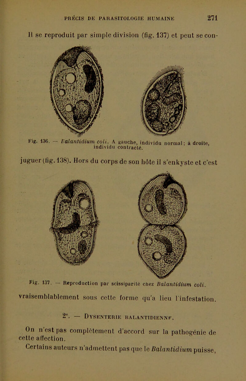 Il se reproduit par simple division (fig. 137) et peut se con- tig. 136. halOintidium coli. A gauche, individu normal; à droite, individu contracté. juguer (fig, 138). Hors du corps de son hôte il s’enkyste et c’est Fig. 137. — Reproduction par scissiparité chez Balantidium coli. vraisemblablement sous cette forme qu’a lieu l'infestation. 2°. — Dysenterie balantidienne. On n’est pas complètement d’accord sur la pathogénie de cette alTection. Certains auteurs n’admettent pas que le Bafanfidmm puisse,