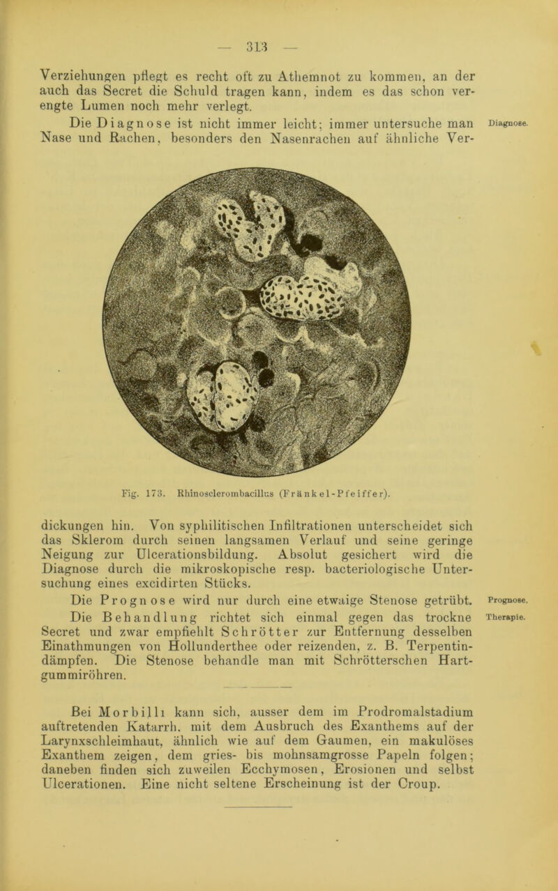 Verziehungen pflegt es recht oft zu Athemnot zu kommen, an der auch das Secret die Schuld tragen kann, indem es das schon ver- engte Lumen noch mehr verlegt. Die Diagnose ist nicht immer leicht; immer untersuche man Diagnose. Nase und Rachen, besonders den Nasenrachen auf ähnliche Ver- Fig. 173. Rhinosclerombacillus (Frank e 1 -Pfe iffer). dickungen hin. Von syphilitischen Infiltrationen unterscheidet sich das Sklerom durch seinen langsamen Verlauf und seine geringe Neigung zur Ulcerationsbildung. Absolut gesichert wird die Diagnose durch die mikroskopische resp. bacteriologische Unter- suchung eines excidirten Stücks. Die Prognose wird nur durch eine etwaige Stenose getrübt. Prognose. Die Behandlung richtet sich einmal gegen das trockne Therapie. Secret und zwar empfiehlt Schrott er zur Entfernung desselben Einathmungen von Hollunderthee oder reizenden, z. B. Terpentin- dämpfen. Die Stenose behandle man mit Schrötterschen Hart- gummiröhren. Bei Morbilli kann sich, ausser dem im Prodromalstadium auftretenden Katarrh, mit dem Ausbruch des Exanthems auf der Larynxschleimhaut, ähnlich wie auf dem Gaumen, ein makulöses Exanthem zeigen, dem gries- bis mohnsamgrosse Papeln folgen; daneben finden sich zuweilen Ecchymosen, Erosionen und selbst Ulcerationen. Eine nicht seltene Erscheinung ist der Croup.