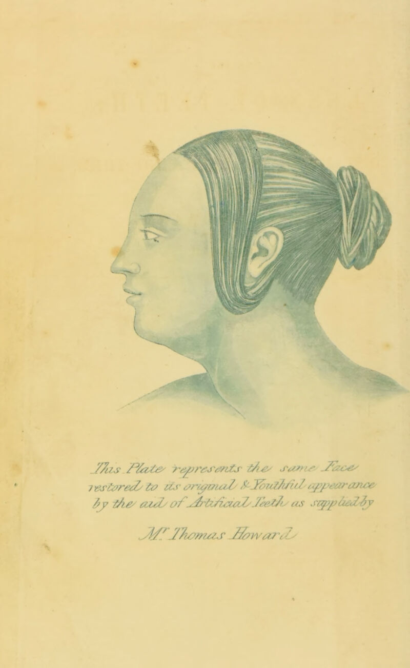 • — .77ns fflzsie' dir; rumr JTzc^ ivs&retZs t& sLy ar/pmaT/ bJcmZ/i/id appearance? fry d/e' azd/ of ddtdzaad/Jd.z/a as sapp&dly Jt/fdTiosruzs JfowM'tZs