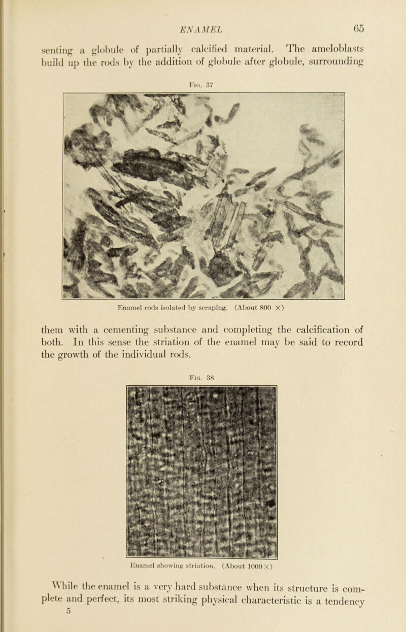 a globule of partially calcified material. The ameloblasts build up the rods by the addition of globule after globule, surrounding senting Fig. 37 Enamel rods isolated by scraping. (About 800 X) them with a cementing substance and completing the calcification of both. In this sense the striation of the enamel may be said to record the growth of the individual rods. Fig. 38 Enamel showing striation. (About 1000 X) While the enamel is a very hard substance when its structure is com- plete and perfect, its most striking physical characteristic is a tendency
