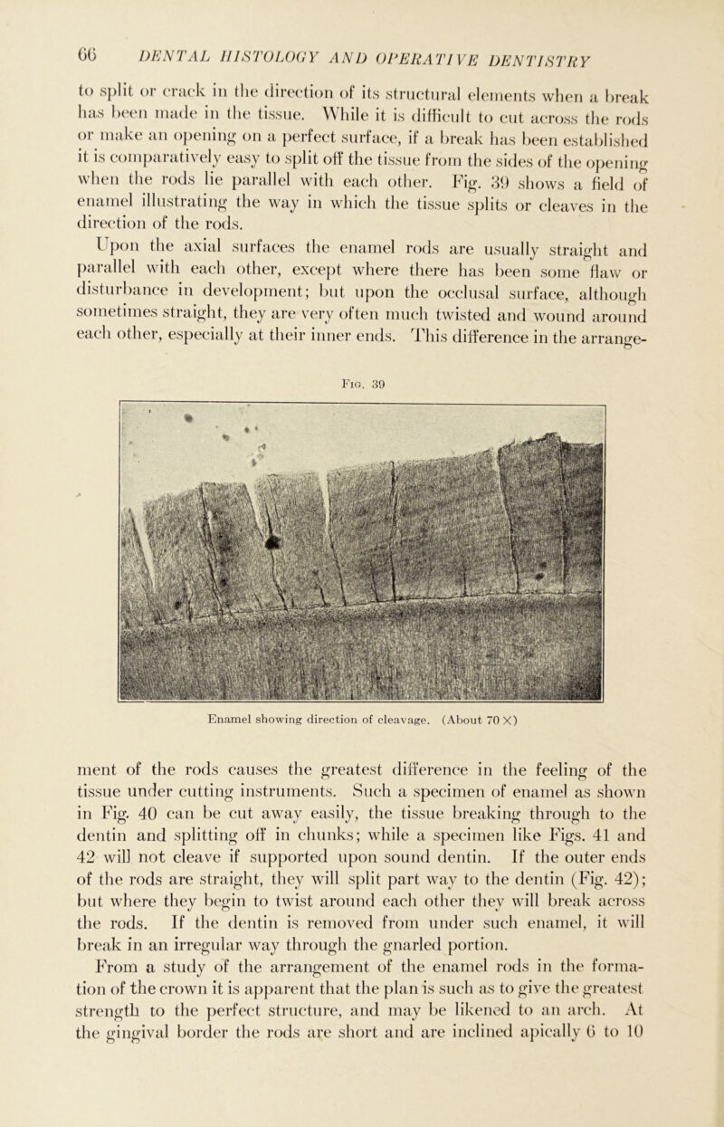 GG to split or crack in the direction of its structural elements when a break has been made in the tissue. While it is difficult to cut across the rods or make an opening on a perfect surface, if a break has been established it is comparatively easy to split off the tissue from the sides of the opening when the rods lie parallel with each other. Fig. 39 shows a field of enamel illustrating the way in which the tissue splits or cleaves in the direction of the rods. Upon the axial surfaces the enamel rods are usually straight and parallel with each other, except where there has been some flaw or disturbance in development; but upon the occlusal surface, although sometimes straight, they are very often much twisted and wound around each other, especially at their inner ends. Fhis difference in the arrange- Fig. 39 Enamel showing direction of cleavage. (About 70 X) ment of the rods causes the greatest difference in the feeling of the tissue under cutting instruments. Such a specimen of enamel as shown in Fig. 40 can be cut away easily, the tissue breaking through to the dentin and splitting off in chunks; while a specimen like Figs. 41 and 42 will not cleave if supported upon sound dentin. If the outer ends of the rods are straight, they will split part way to the dentin (Fig. 42) ; but where they begin to twist around each other they will break across the rods. If the dentin is removed from under such enamel, it will break in an irregular way through the gnarled portion. From a study of the arrangement of the enamel rods in the forma- tion of the crown it is apparent that the plan is such as to give the greatest strength to the perfect structure, and may be likened to an arch. At the gingival border the rods are short and are inclined apically G to 10