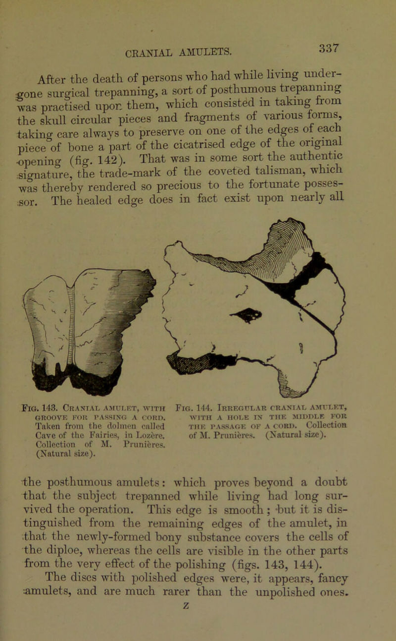 CEANIAL AMULETS. After the death of persons who had while living under- fione surgical trepanning, a sort of posthumous trepanning was practised upon them, which consistéd in taking trom the skull circiüar pièces and fragments of varions torms, taking care always to preserve on one of the edges of each piece of bone a part of the cicatrised edge of the original •opening (fig- 142). That was in some sort the authentic .signature, the trade-mark of the coveted talisman, which was thereby rendered so precious to the fortunate posses- sor. The healed edge does in fact exist upon nearly ail Fig. 143. Cranial amulkt, with Fig. 144. Irregülar cranial amvlet, GROOVE FOR PASSING A CORD. WITII A HOEE IN TUE 5IIDDI.E FOR Taken from the dolmen cnlled the pa.s-sage of a coed. Collectioa Cave of the Fairies, in Lozère. of M. Prunières. (Natural size). Collection of M. Prunière.s. (Naturnl size). the posthumous amulets : which proves beyond a doubt that the subject trepanned while living had long sur- vived the operation. This edge is smooth ; -but it is dis- tinguished from the remaining edges of the amulet, in .that the newly-formed bony substance covers the cells of the diploe, whereas the cells are visible in the other parts from the very efifect of the polishing (figs. 143, 144). The dises with polished edges were, it appears, fancy nmulets, and are much rarer than the unpolished on es. Z