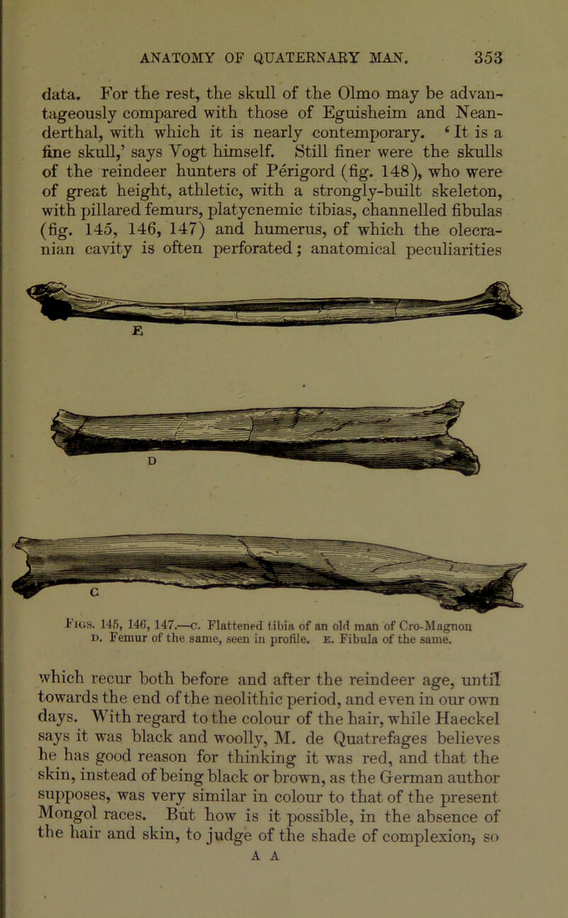 data. For the rest, the skull of the Olmo may be advan- tageously compared with those of Eguisheim and Nean- derthal, with which it is nearly contemporary. ‘ It is a line skull,’ says Vogt himself. Still finer were the skulls of the reindeer hunters of Périgord (fig. 148), who were of great height, athletic, with a strongly-built skeleton, with pillared fémurs, platycnémie tibias, channelled fibulas (fig. 145, 146, 147) and humérus, of which the olecra- nian cavity is often perforated ; anatomical peculiarities Figs. 145, 146,147.—c. Flattened libia of an old man of Cro-Magnon D. Fémur of the sanie, seen in profile, e. Fibula of the same. which recur both before and after the reindeer âge, until towards the end of the neolithic period, and even in our own days. With regard to the colour of the hair, while Haeckel says it was black and woolly, M. de Quatrefages believes he bas good reason for thinking it was red, and that the skin, instead of being black or brown, as the German author supposes, was very similar in colour to that of the présent Mongol races. Bût how is it possible, in the absence of the hair and skin, to judge of the shade of complexion, so A A