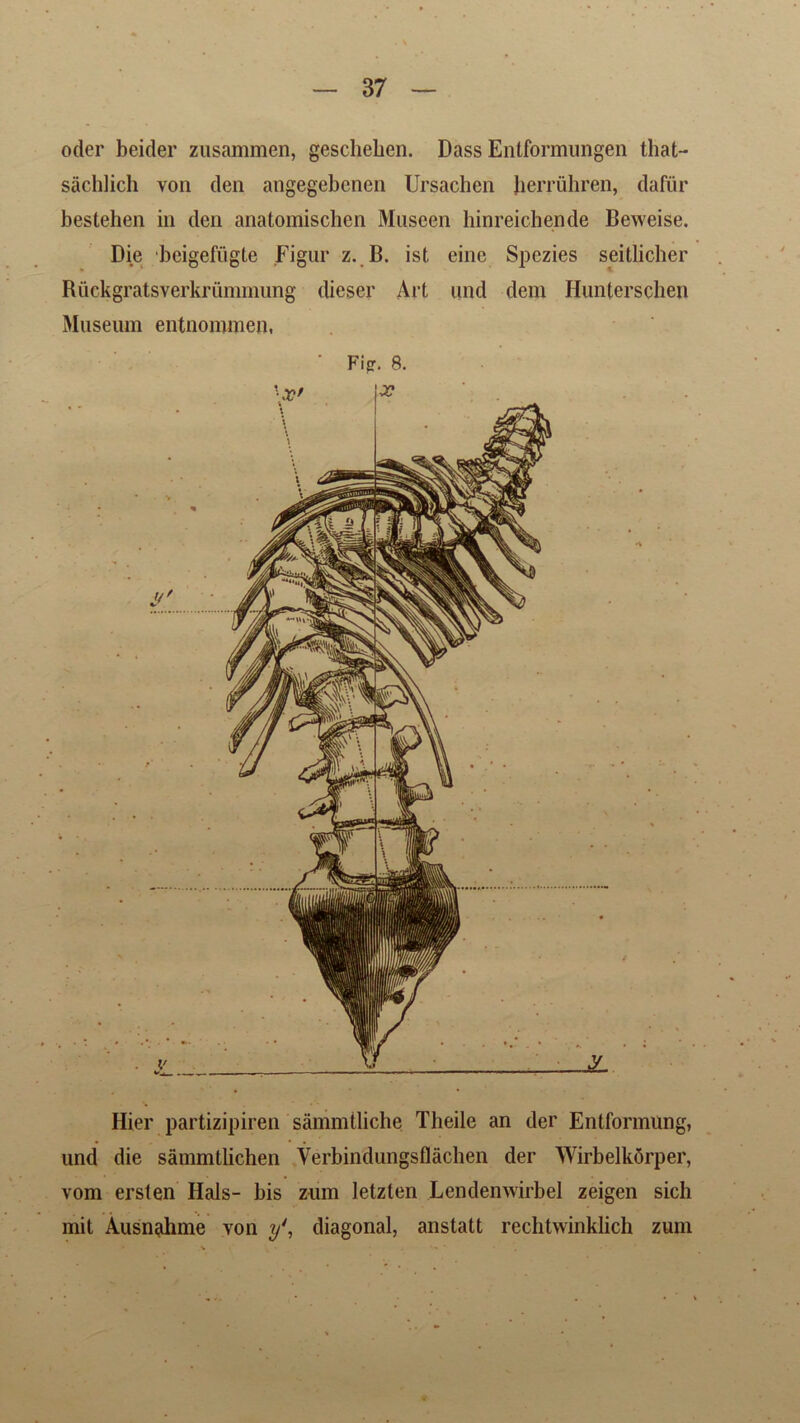 oder beider zusammen, gesclieben. Dass Entformungen that- sachlich von den angegebenen Ursachen herruhren, dafiir bestehen in den anatomischcn Museen hinreichende Beweise. Die beigefiigte Figur z. B. ist eine Spezies seitlicher Ruckgratsverkrummung dieser Art und deni Hunterschen Museum entnonnnen, ‘ Fi8. Hier partizipiren sammtliche Theile an der Entformung, und die sammtlichen Verbindungsflachen der Wirbelkorper, vom ersten Hals- bis zum letzten Lendenwirbel zeigen sicli mit Ausnahme von ydiagonal, anstatt rechtwinklich zum