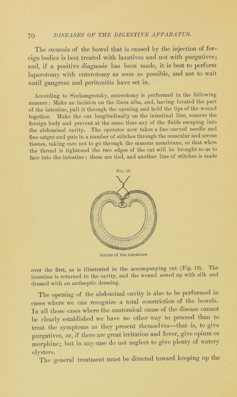 The stenosis of the bowel that is caused by the injection o£ for- eignbodies is best treated with laxatives and not with purgatives; and, if a positive diagnosis lias been made, it is best to perform laparotomy with enterotomy as soon as possible, and not to wait nntil gangreue and peritonitis liave set in. According to Siedamgrotzky, enterotomy is performed in the following manner: Make an incision on the linea alba, and, having located the part of the intestine, pull it through the opening and hold the lips of the wound together. Make the cut longitudinally on the intestinal line, remove the foreign body and prevent at the same time any of the fluids escaping into the abdominal cavity. The operator now takes a fine curved needle and fine catgut and puts in a number of stitches through the muscular and serous tissues, taking care not to go through the mucous membrane, so that when the thread is tightened the two edges of the cut will be brought so as to face into the intestine; these are tied, and another line of stitches is made Fig. 19. Suture of the intestines. over the first, as is illustrated in the accompanying cut (Fig. 19). The intestine is returned to the cavity, and the wound sewed up with silk and dressed with an antiseptic dressing. The opening of the abdominal cavity is also to be performed in cases where we can recogmze a total constriction of the boweis. In all those cases wliere the anatomical cause of the disease cannot be clearly established we have no other way to proceed than to treat the Symptoms as they present tliemselves—that is, to give purgatives, or, if there are great irritation and fever, gi\e opium oi morphine; but in any case do not neglect to give plenty of vatei v elysters. The general treatment must be directed toward keeping up the