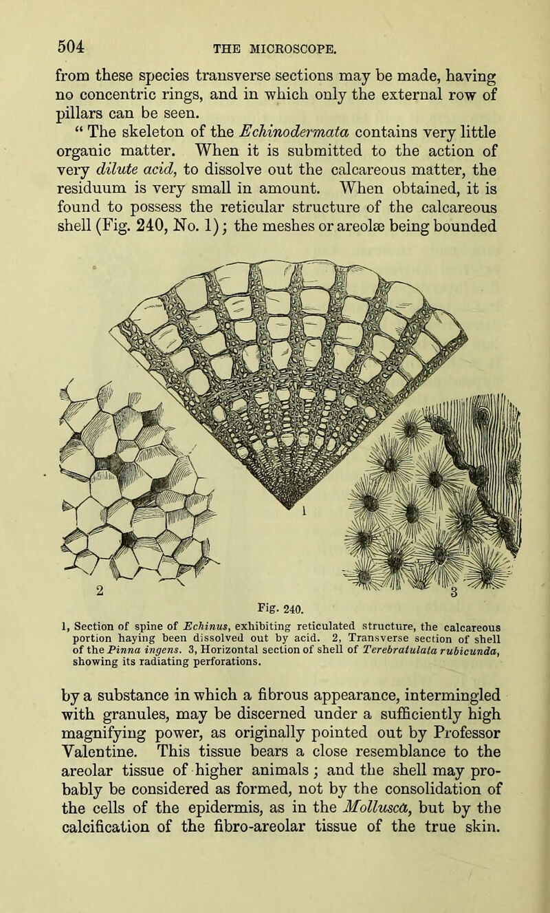 from these species transverse sections may be made, having no concentric rings, and in which only the external row of pillars can be seen. “ The skeleton of the Echinodermata contains very little organic matter. When it is submitted to the action of very dilute acid, to dissolve out the calcareous matter, the residuum is very small in amount. When obtained, it is found to possess the reticular structure of the calcareous shell (Fig. 240, No. 1); the meshes or areolae being bounded Fig- 240. 1, Section of spine of Echinus, exhibiting reticulated structure, the calcareous portion haying been dissolved out by acid. 2, Transverse section of shell of the Pinna ingens. 3, Horizontal section of shell of Terebraiulata rubicunda, showing its radiating perforations. by a substance in which a fibrous appearance, intermingled with granules, may be discerned under a sufficiently high magnifying power, as originally pointed out by Professor Valentine. This tissue bears a close resemblance to the areolar tissue of higher animals; and the shell may pro- bably be considered as formed, not by the consolidation of the cells of the epidermis, as in the Molluscd, but by the calcification of the fibro-areolar tissue of the true skin.