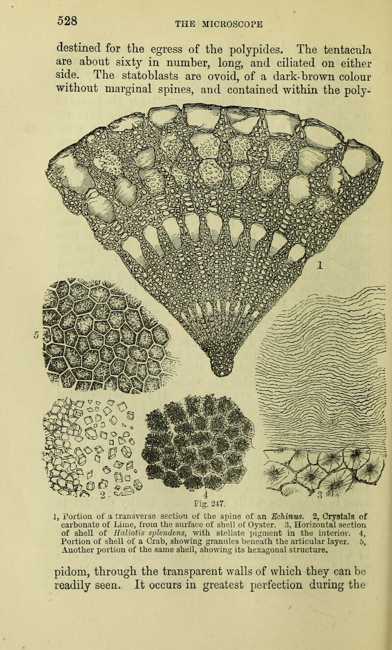 THE MICROSCOPE destined for tlie egress of tlie polypides. The tentacula are about sixty in number, long, and ciliated on either side. The statoblasts are ovoid, of a dark-brown colour without marginal spines, and contained within the poly- Fig. 247. 1, Portion of a transverse section of the spine of an Echinus. 2, Crystals of carbonate of Lime, from the surface of shell of Oyster. 3, Horizontal section of shell of Haliotis splendens, with stellate pigment in the interior. 4, Portion of shell of a Crab, showing granules beneath the articular layer. 5, Another portion of the same shell, showing its hexagonal structure. pidom, through the transparent walls of which they can be readily seen. It occurs in greatest perfection during the